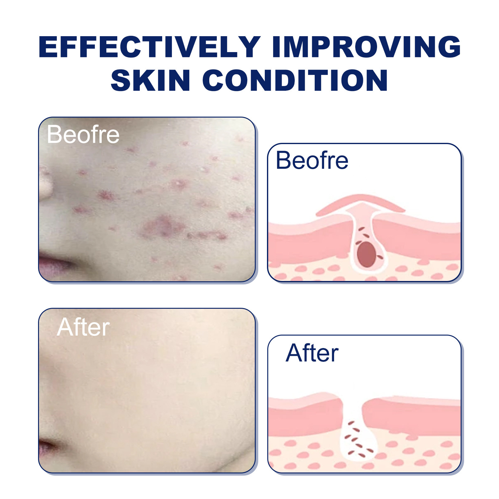 HOYGI Deep Mild Oil Control&Moisturizing foam Mousse Compact Facial Cleanser_voghion.com
