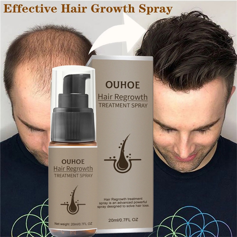Leistungsstarkes Haarwuchs-Serum-Spray mit Ingwer, Anti-Haarausfall-Behandlungsprodukte, Reparatur, Pflege der Haarwurzeln, schnelles Nachwachsen der Haare bei Männern und Frauen_voghion.com