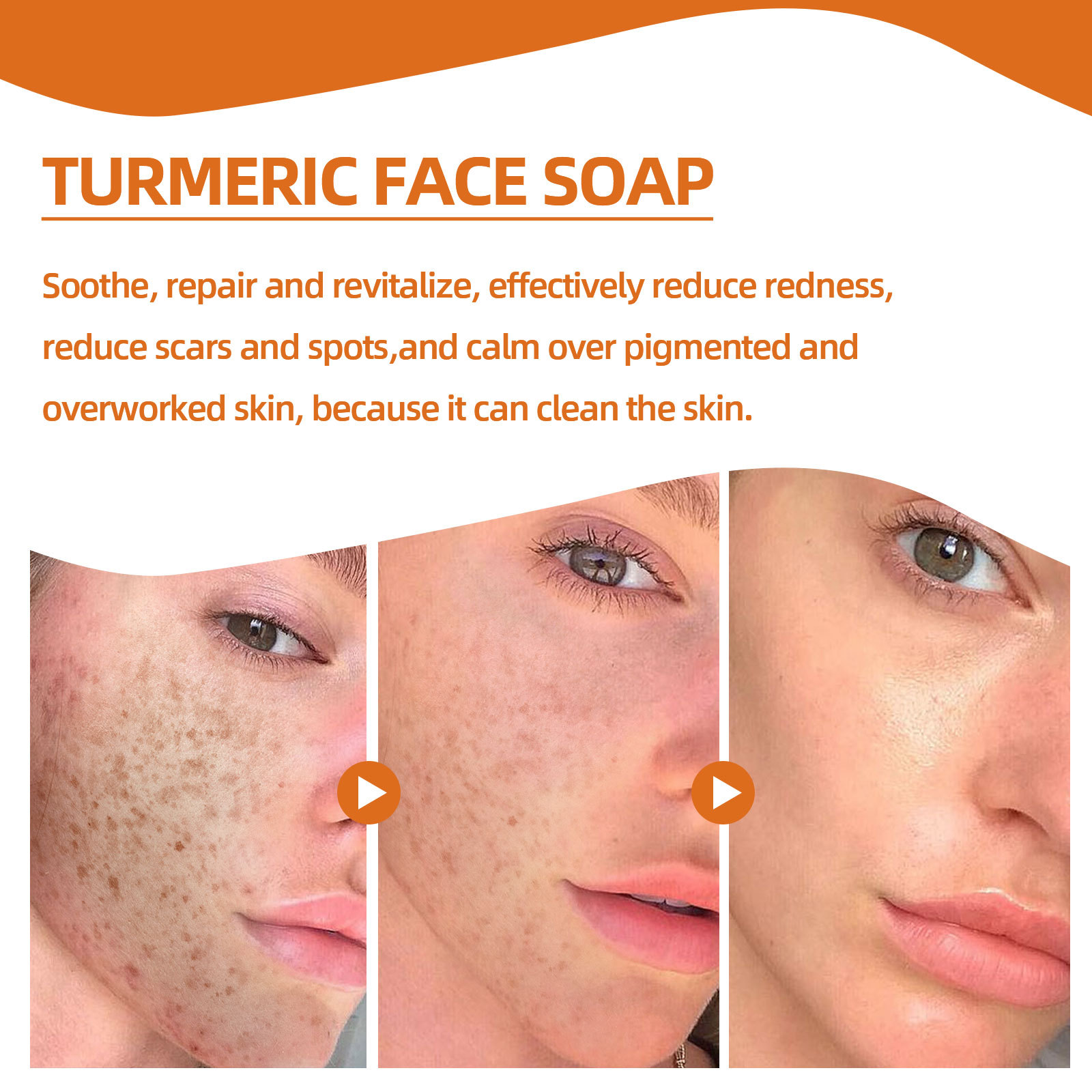 West&Month Curcuma Facial Repair Nettoyage doux, décoloration des taches, lissage des ridules savon nettoyant_voghion.com