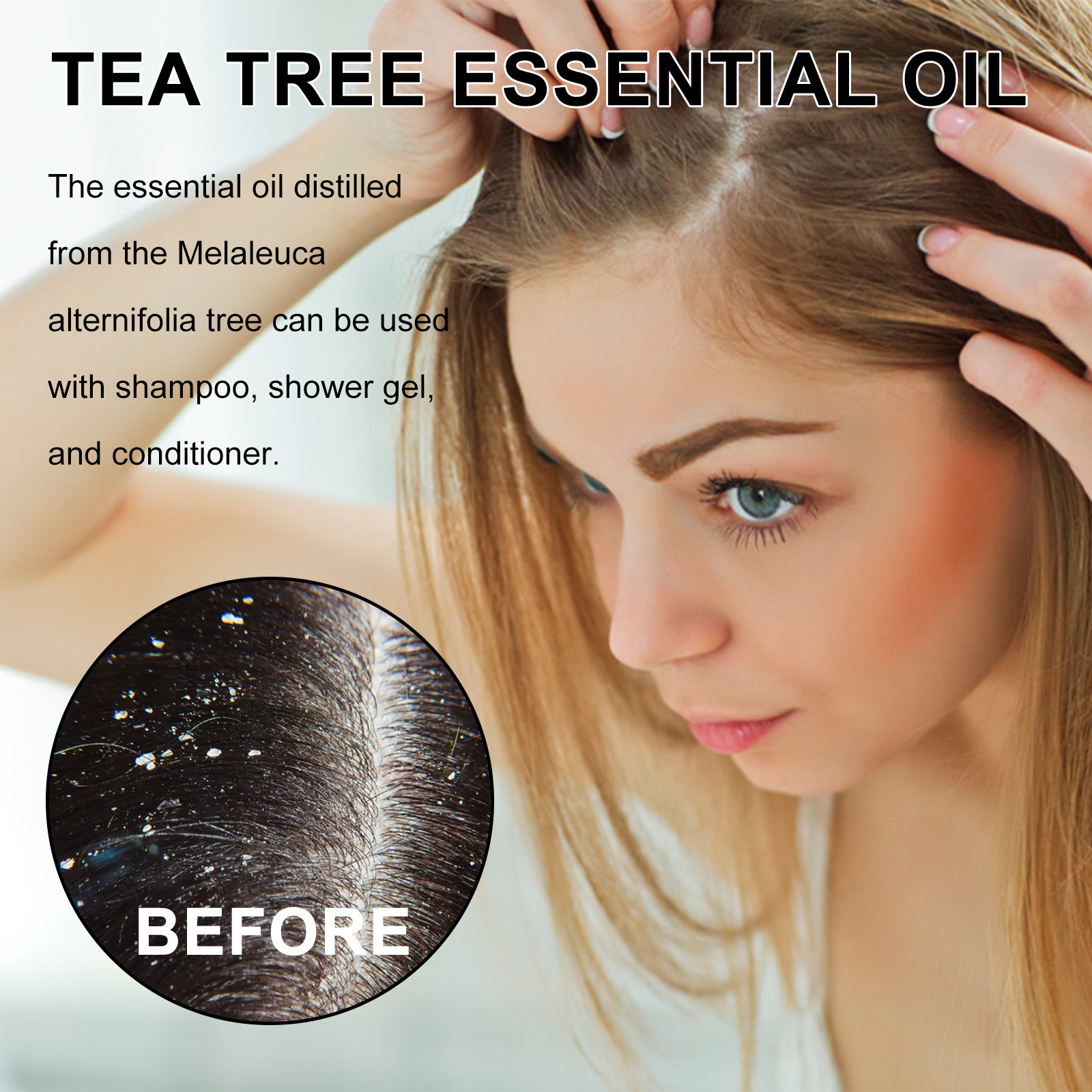 Siero all'olio essenziale di tea tree per capelli e pelle_voghion.com