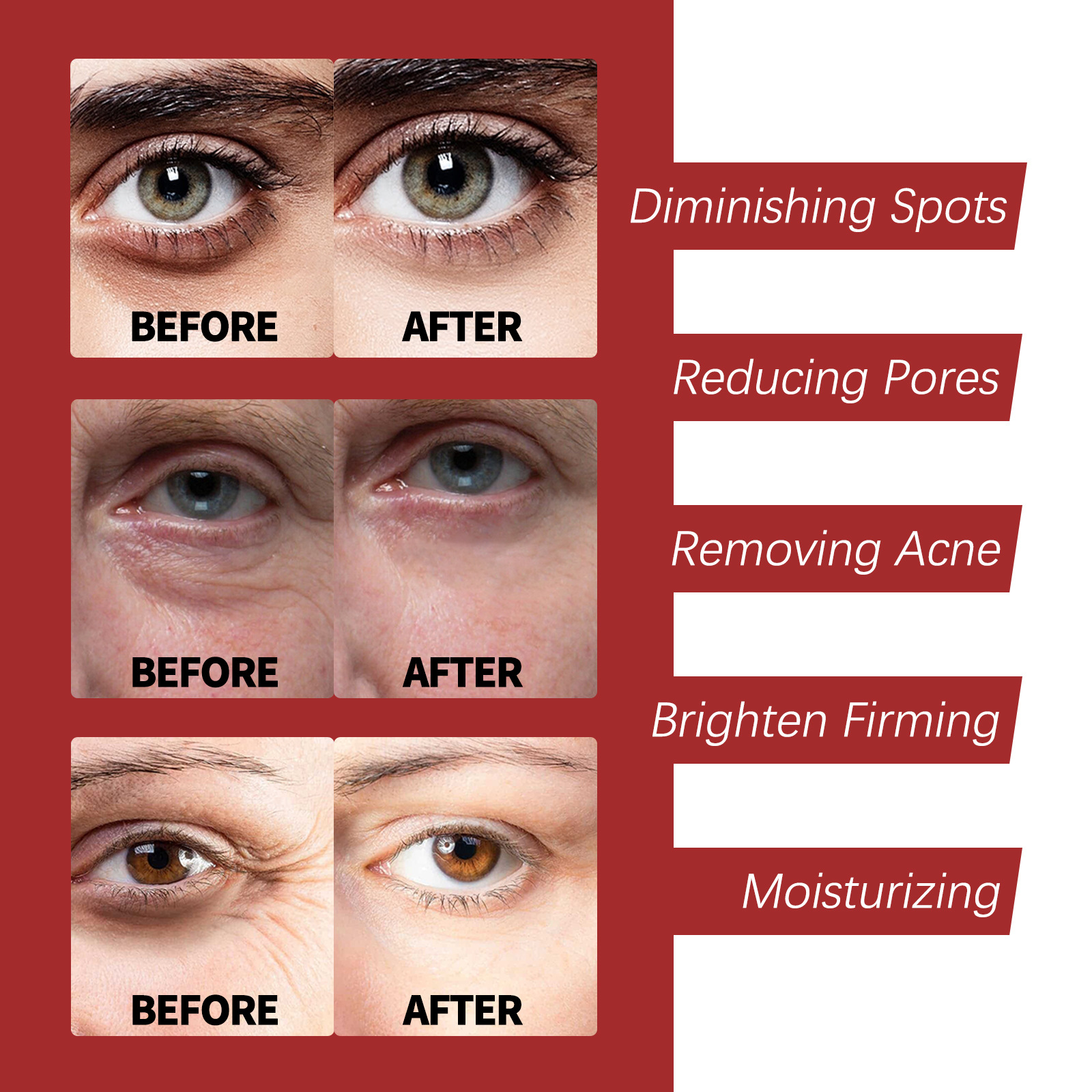 OUHOE Retinol Moisturizing Lightens Fine Lines, Tightens Black Eyes, Moisturizes Pores, wrinkle and Anti aging face_voghion.com