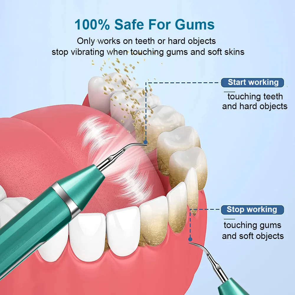 Dissolvant de tartre et de tartre dentaire, hygiène buccale, nettoyage Ultra sonique de la Plaque dentaire, pierre de nettoyage des dents, nouveauté 2023_voghion.com