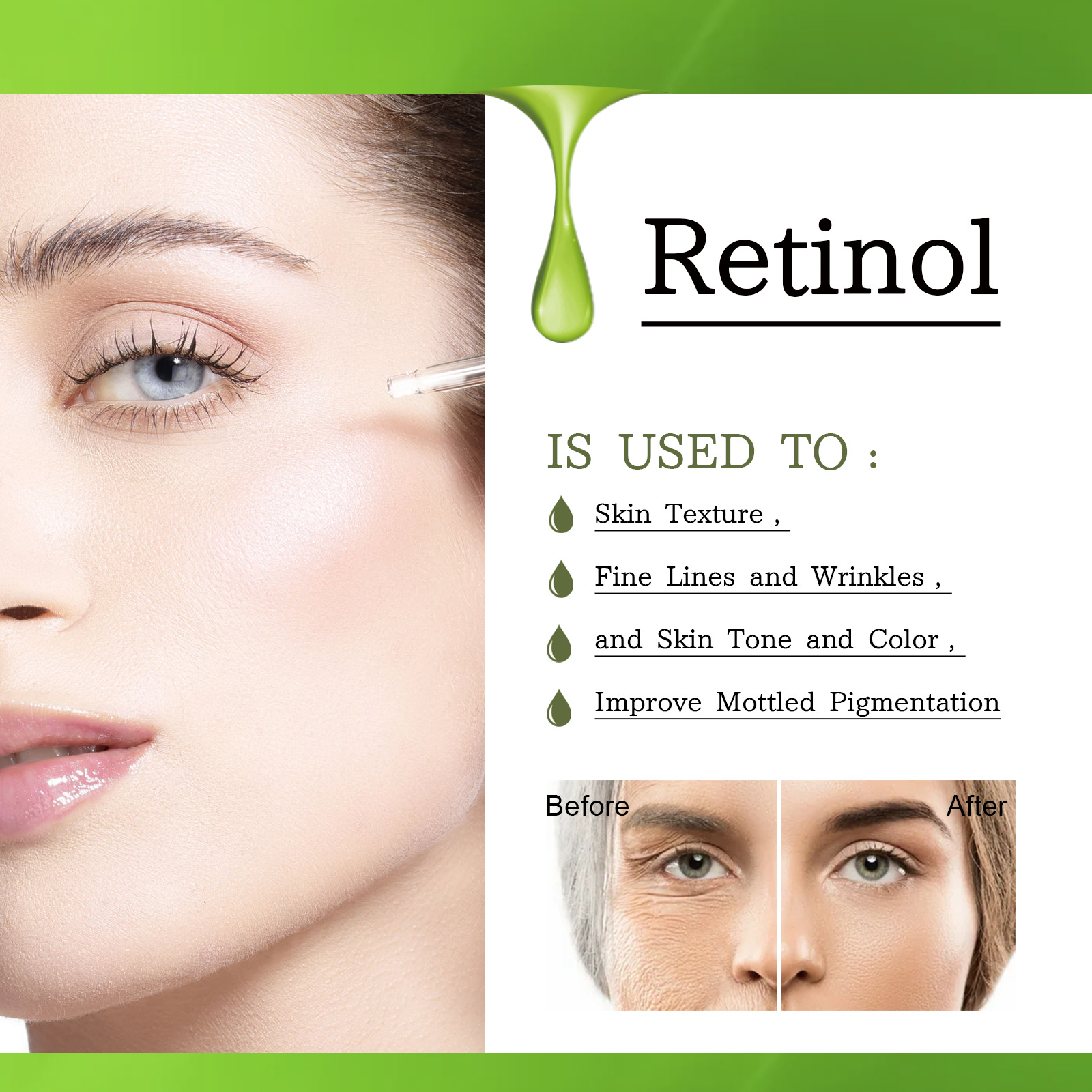 OUHOE Essenza di retinolo Antirughe, rassodante, illuminante e riparatrice delle linee sottili intorno agli occhi_voghion.com