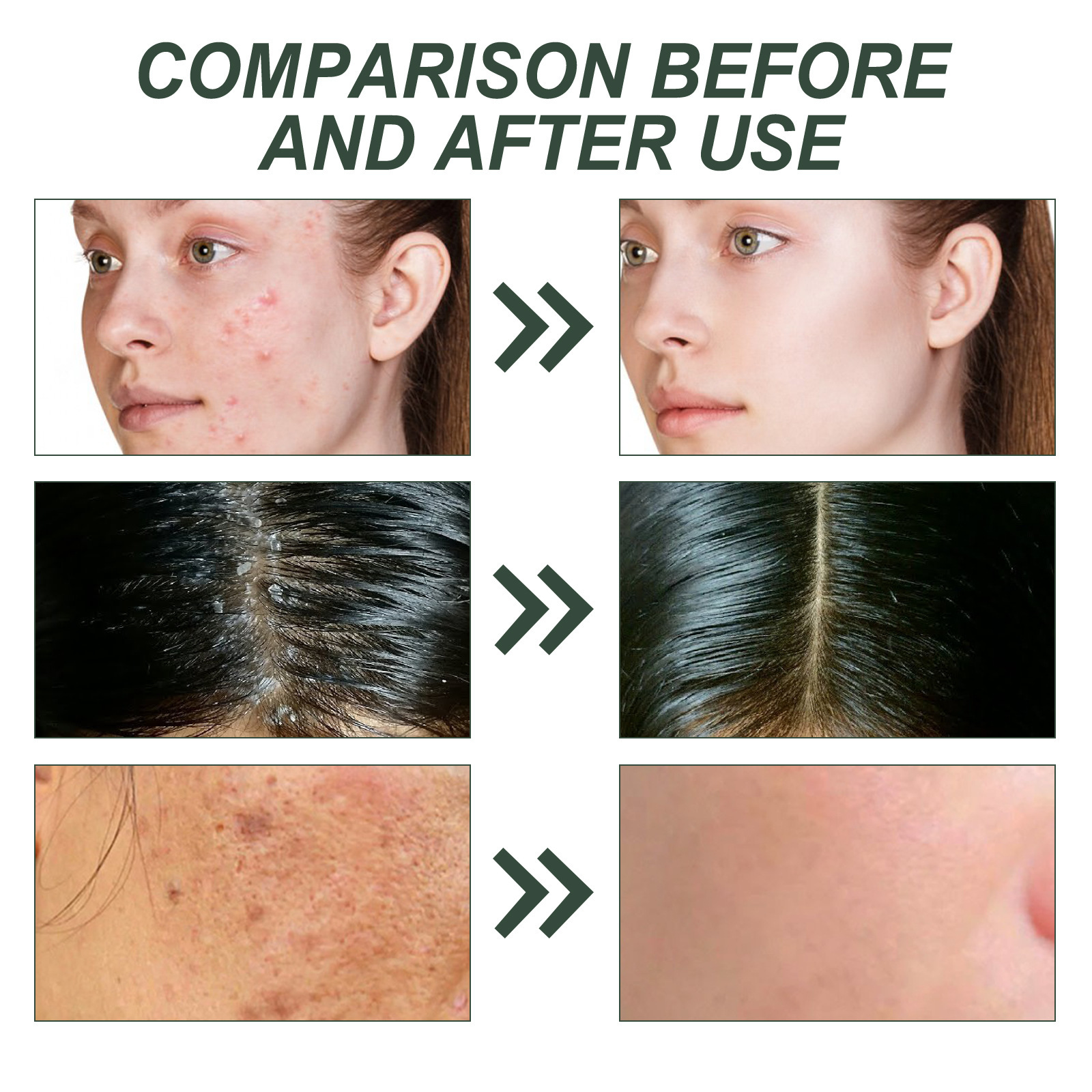 WoodSleep rozmaring masszázs esszenciális arcápoló pattanásjavító, hidratáló, hidratáló és simító bőrápoló olaj_voghion.com