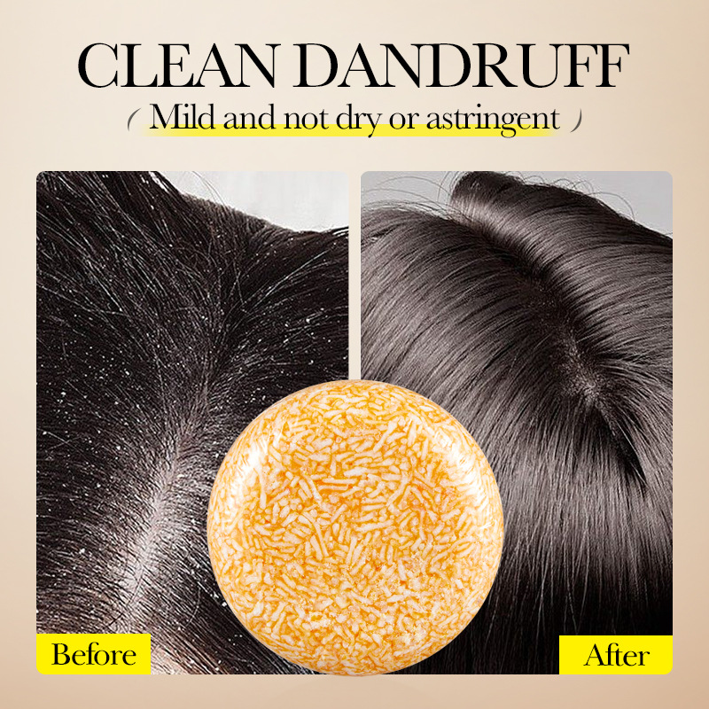 SADOER Ginger Hair Strengthening Shampoo 60g | Herbal Plant Extract For Dandruff And Oil Control, Awakening Scalp Vitality! Unisex_voghion.com