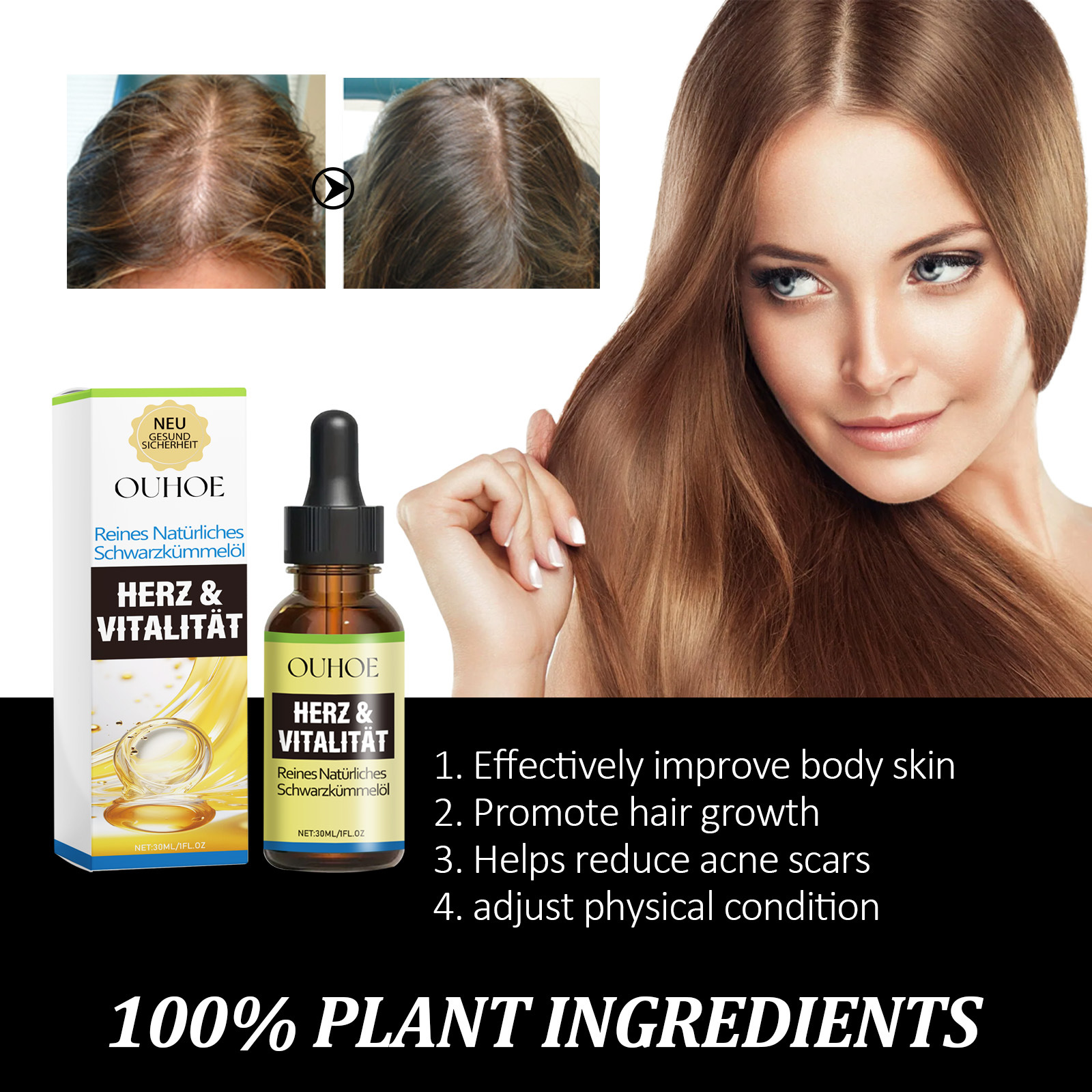 OUHOE Olejek z czarnuszki naprawczy, przeciw wypadaniu włosów, napiętym włosom, swędzeniu skóry, zaczerwienieniom i łuszczeniu się skóry_voghion.com