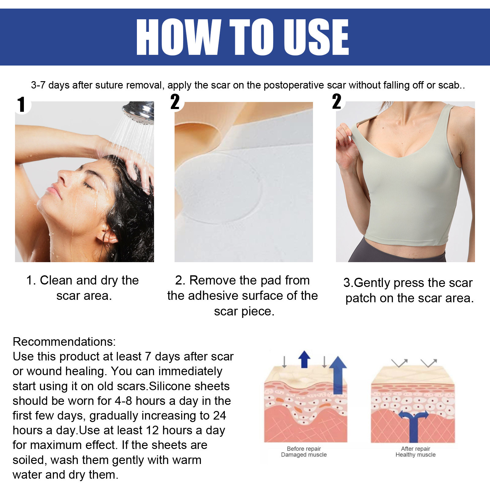 Le patch anti-cicatrice EELHOE répare la peau de manière confortable, légère et lisse les cicatrices de chirurgie mammaire_voghion.com