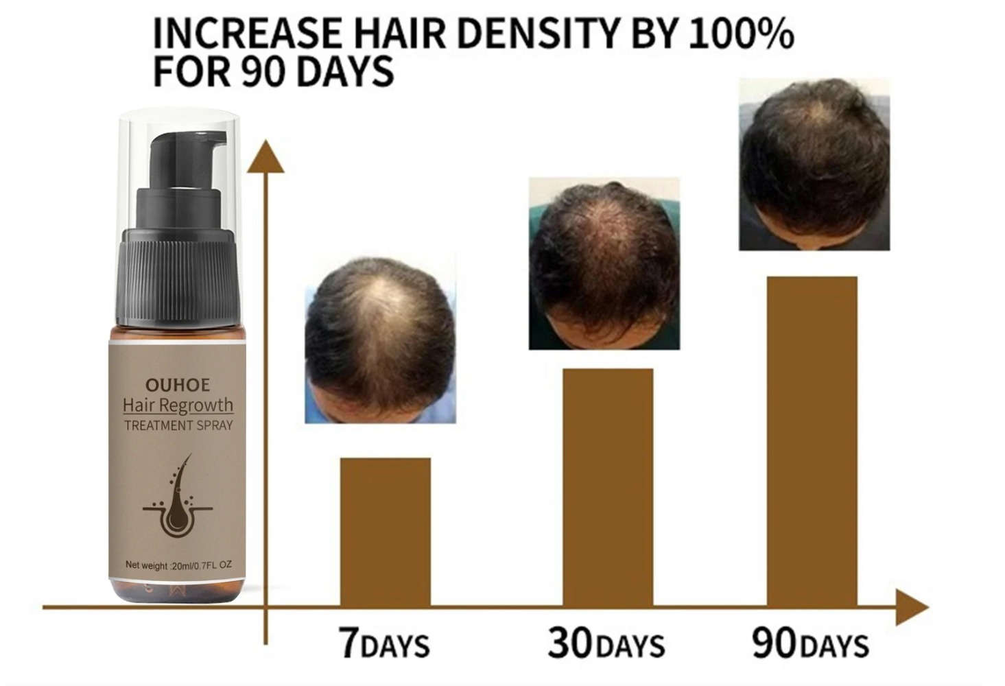 Leistungsstarkes Haarwuchs-Serum-Spray mit Ingwer, Anti-Haarausfall-Behandlungsprodukte, Reparatur, Pflege der Haarwurzeln, schnelles Nachwachsen der Haare bei Männern und Frauen_voghion.com