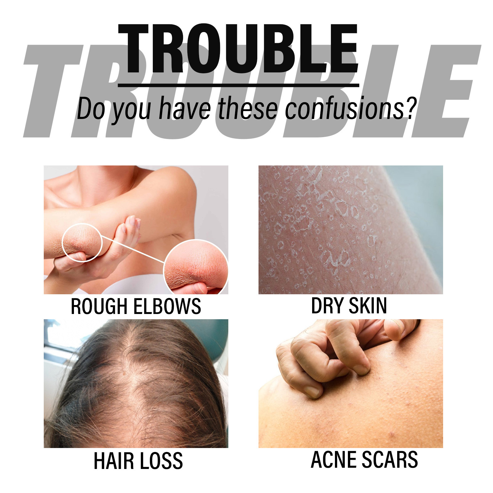 OUHOE Olejek z czarnuszki naprawczy, przeciw wypadaniu włosów, napiętym włosom, swędzeniu skóry, zaczerwienieniom i łuszczeniu się skóry_voghion.com