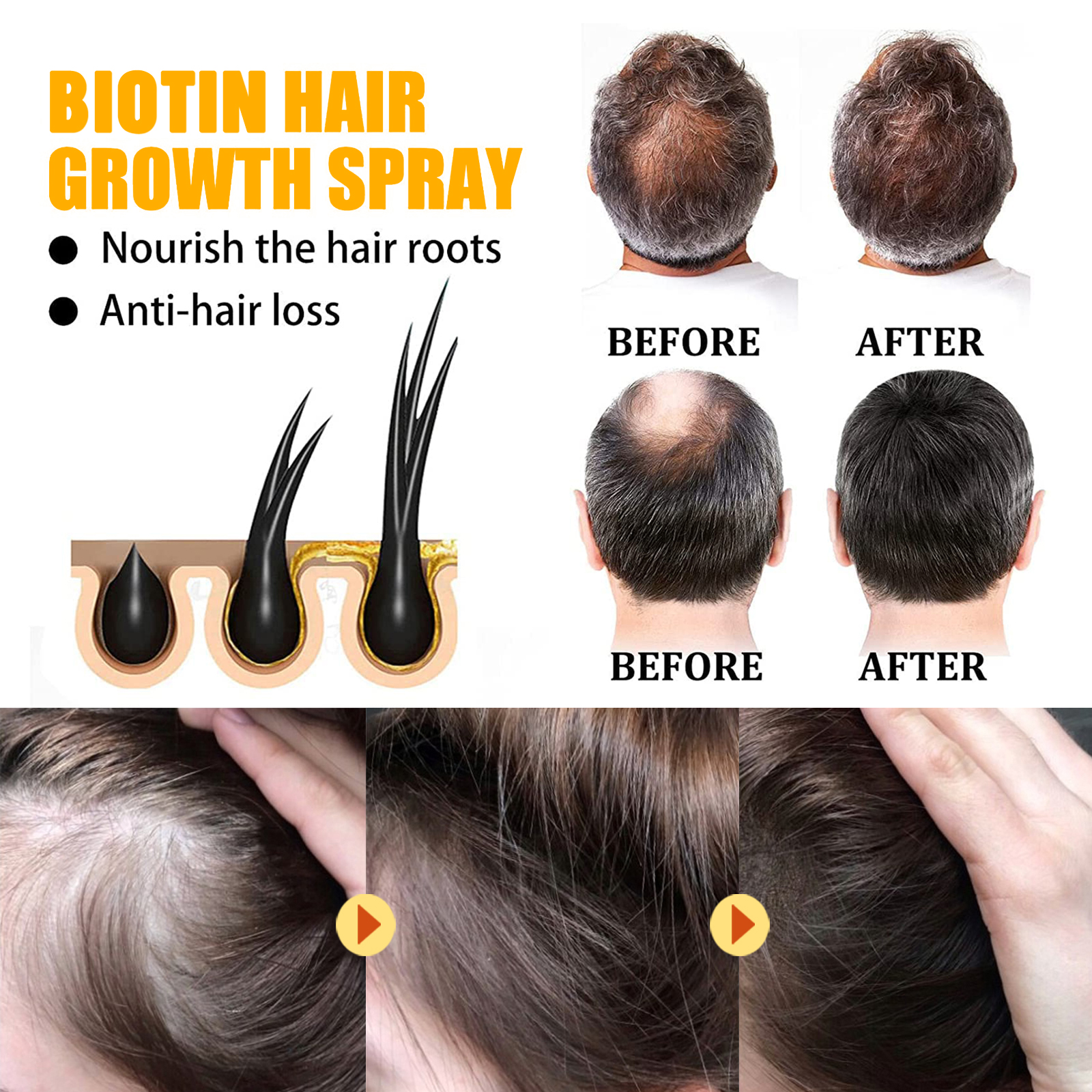 Spray de biotina para el crecimiento del cabello EELHOE: spray reparador y anticaída para el cuidado del cabello y estabilización de raíces._voghion.com