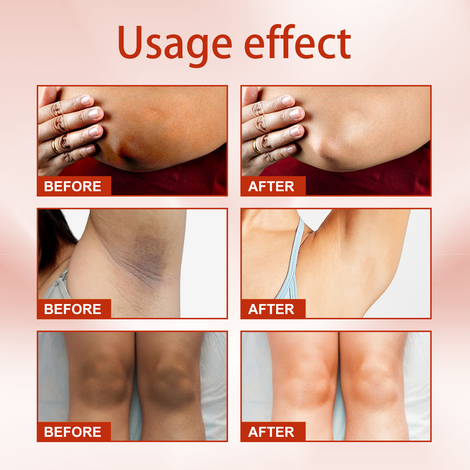 EELHOE Dorn Hautpflege zu reinigen Cutin Melanin Reparatur Achselgelenk schwarz und weiß Spray_voghion.com