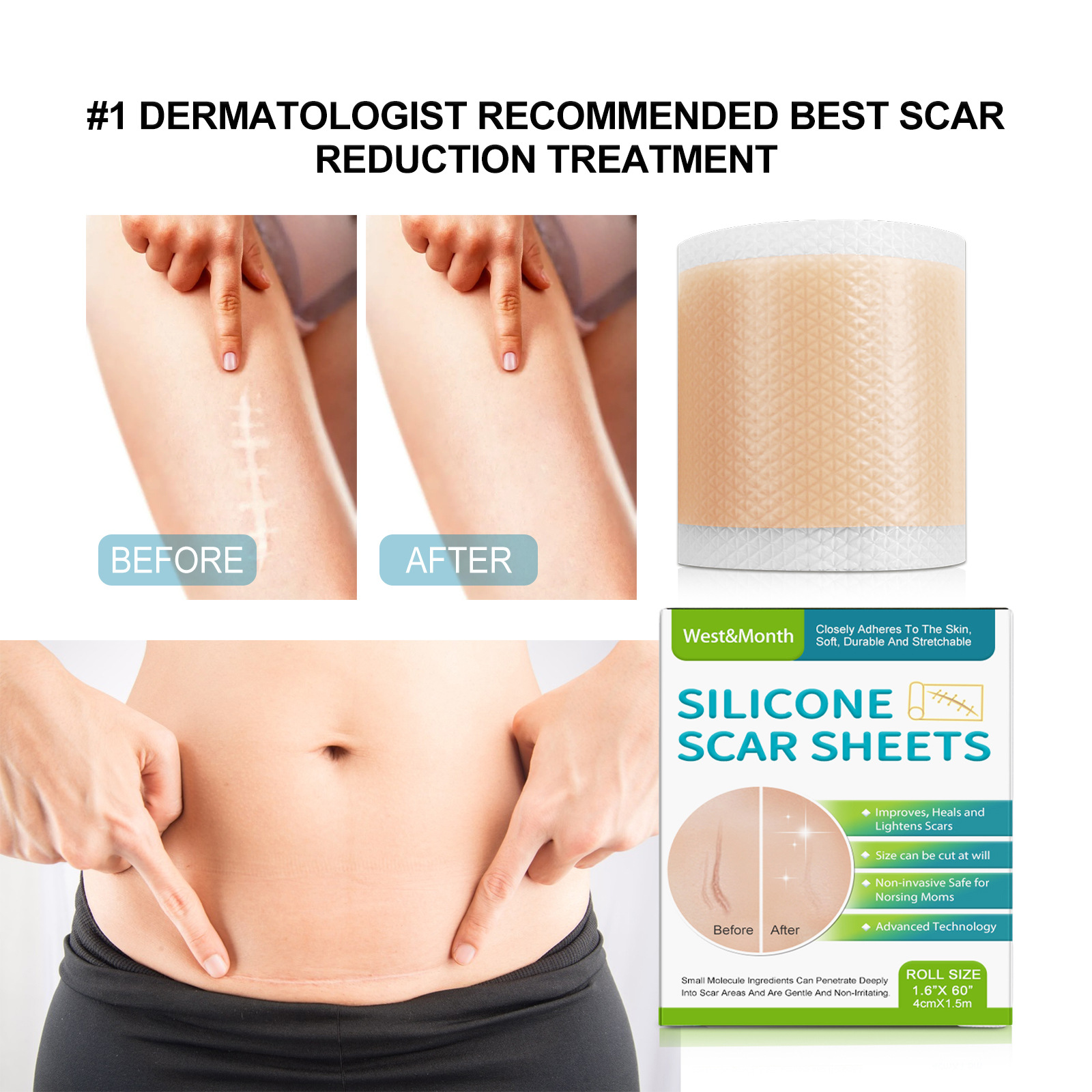 Silikonová samolepicí náplast na jizvy West&Month pro opravu pomerančové kůry, zarůstajících vrásek, vyhlazující péči o pleť a krásu_voghion.com