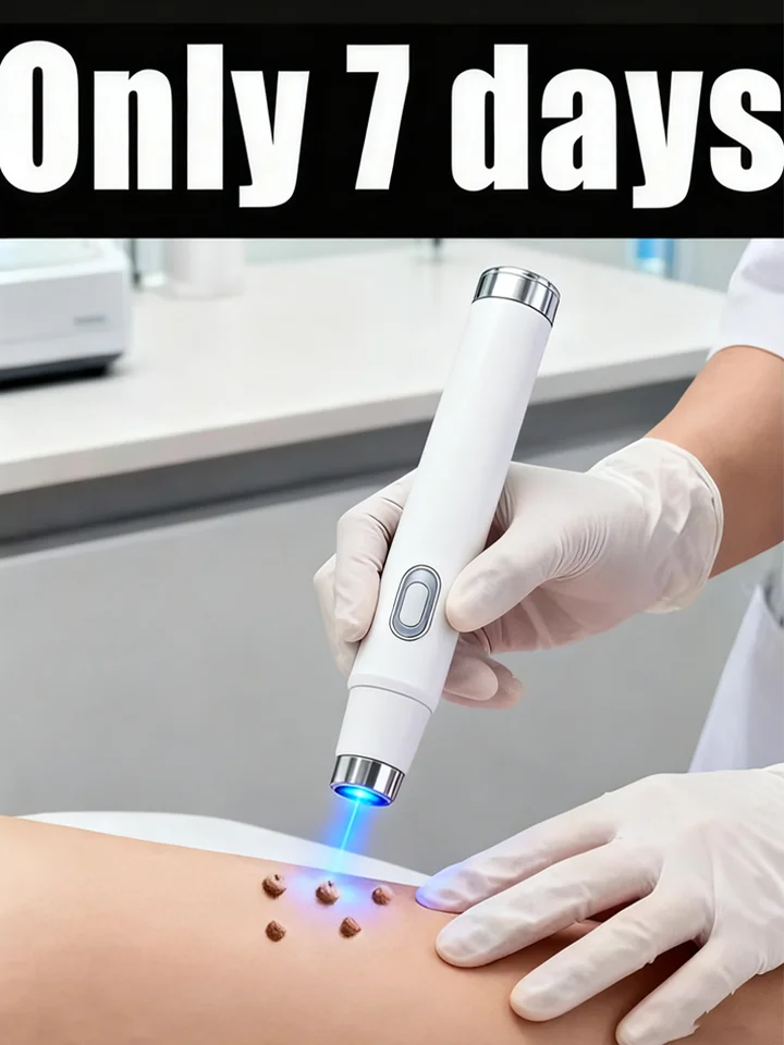 Warts Blue Light Device For Skin Care Easy Cleaning_voghion.com