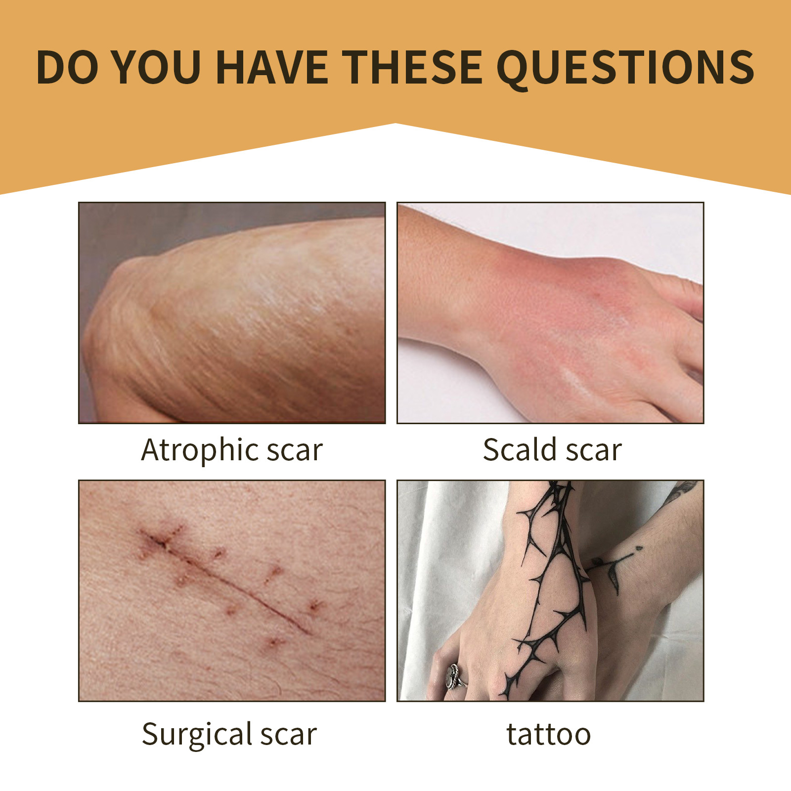 Jayswing tattoo scar concealer invisible waterproof skin color mask sticker_voghion.com