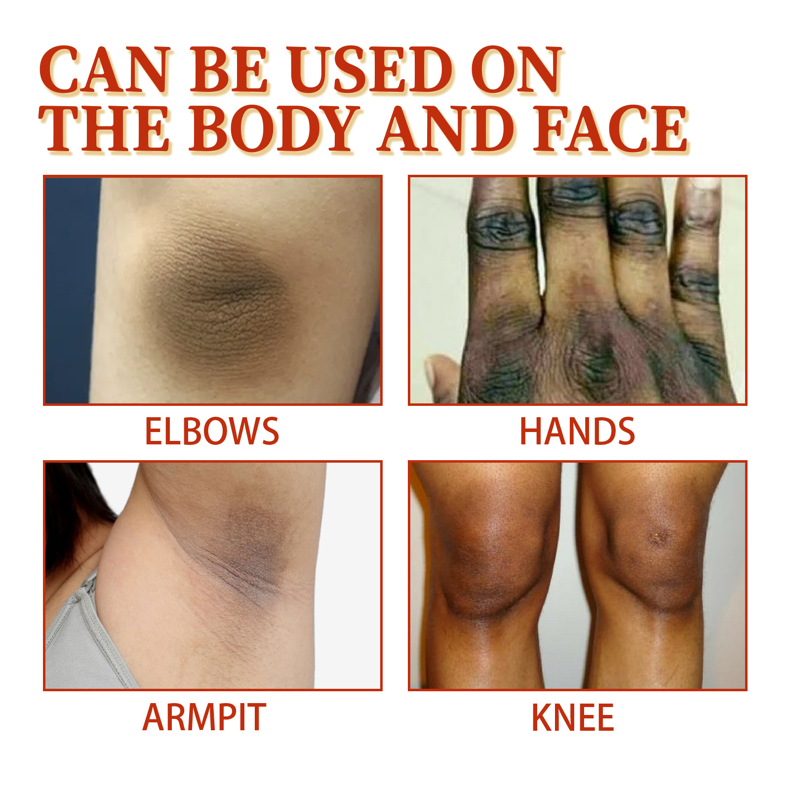 EELHOE Dorn Hautpflege zu reinigen Cutin Melanin Reparatur Achselgelenk schwarz und weiß Spray_voghion.com