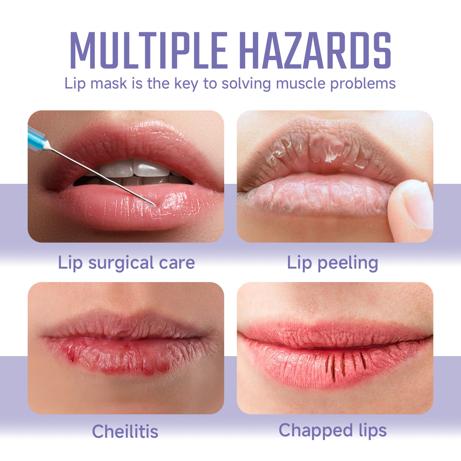 OUHOE Collagen Repair Lines, entfernt abgestorbene Hautzellen, verhindert trockene Risse, spendet Feuchtigkeit und pflegt die Lippenmaske_voghion.com