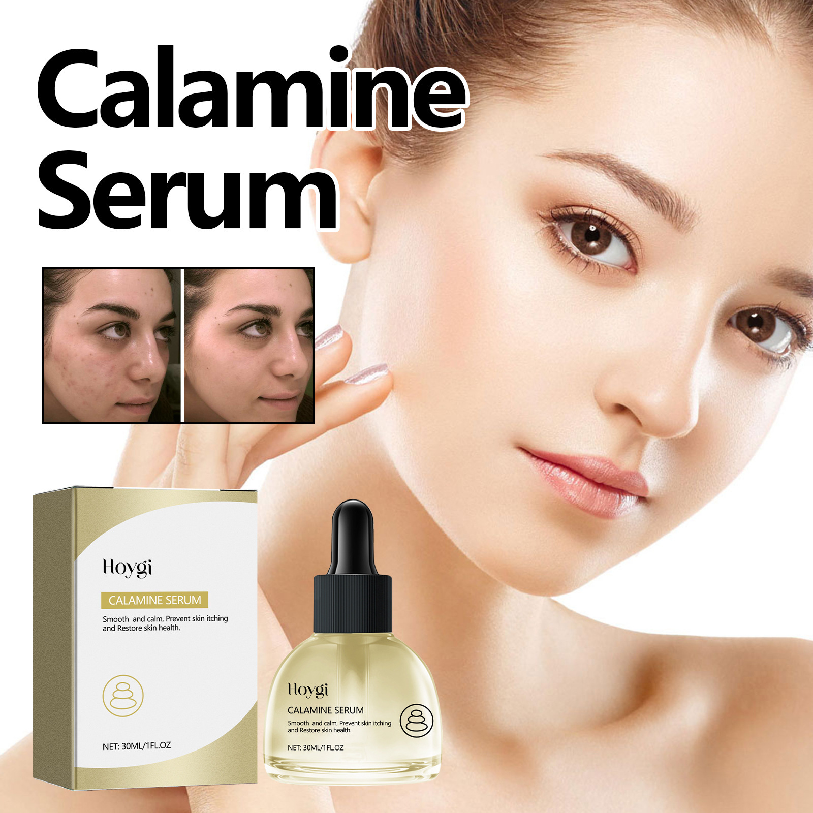 Esența facială de calamină Hoygi îmbunătățește uscăciunea, aspectul tern al pielii, acneea, hidratează și conferă volum pielii._voghion.com