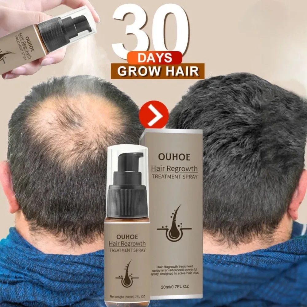 Leistungsstarkes Haarwuchs-Serum-Spray mit Ingwer, Anti-Haarausfall-Behandlungsprodukte, Reparatur, Pflege der Haarwurzeln, schnelles Nachwachsen der Haare bei Männern und Frauen_voghion.com