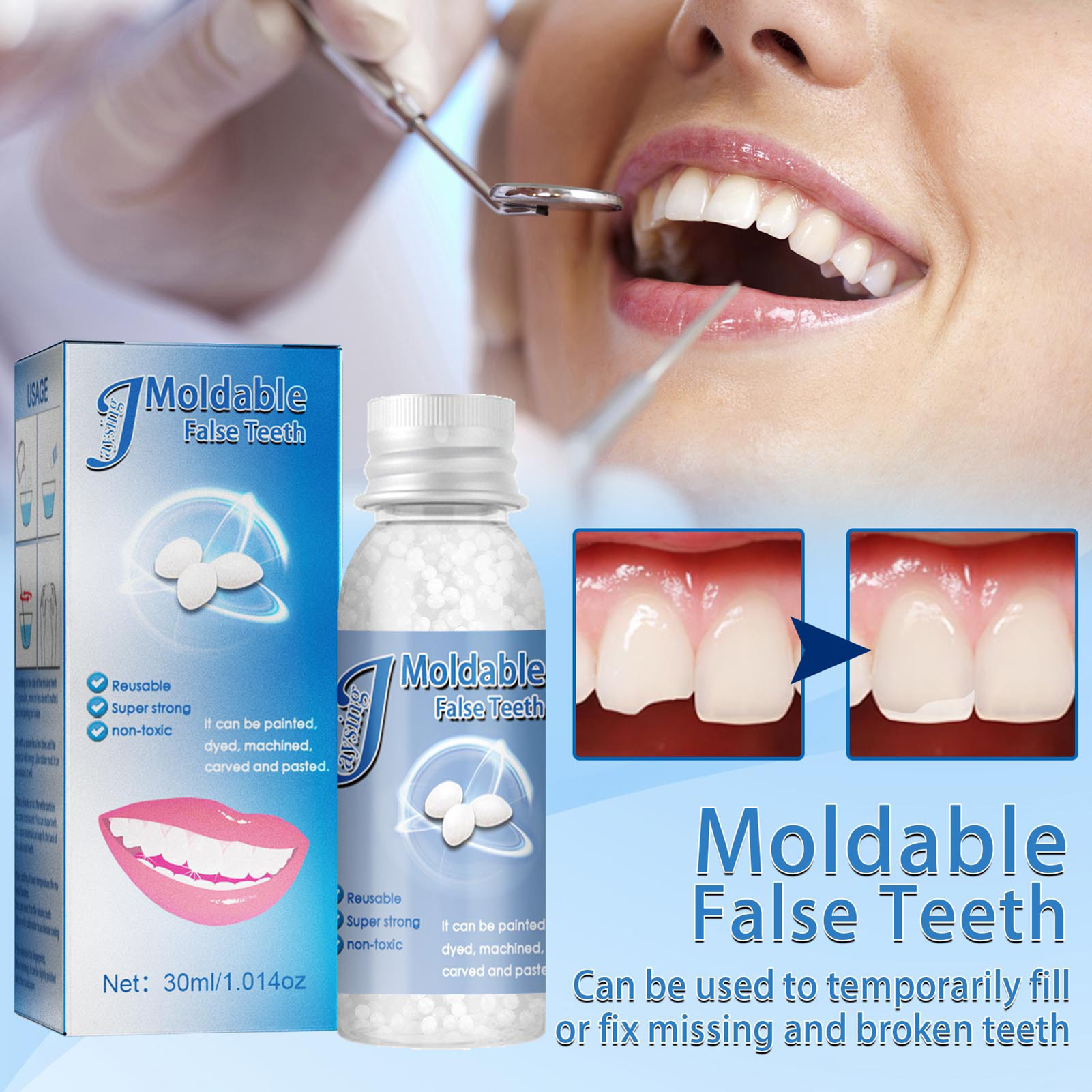 1 boîte 30 ml de colle pour les dents bricolage cosplay dents shapeable restauration dentaire haute flexibilité remplissage temporaire rapide fonte des dents perles de remplacement pour la maison