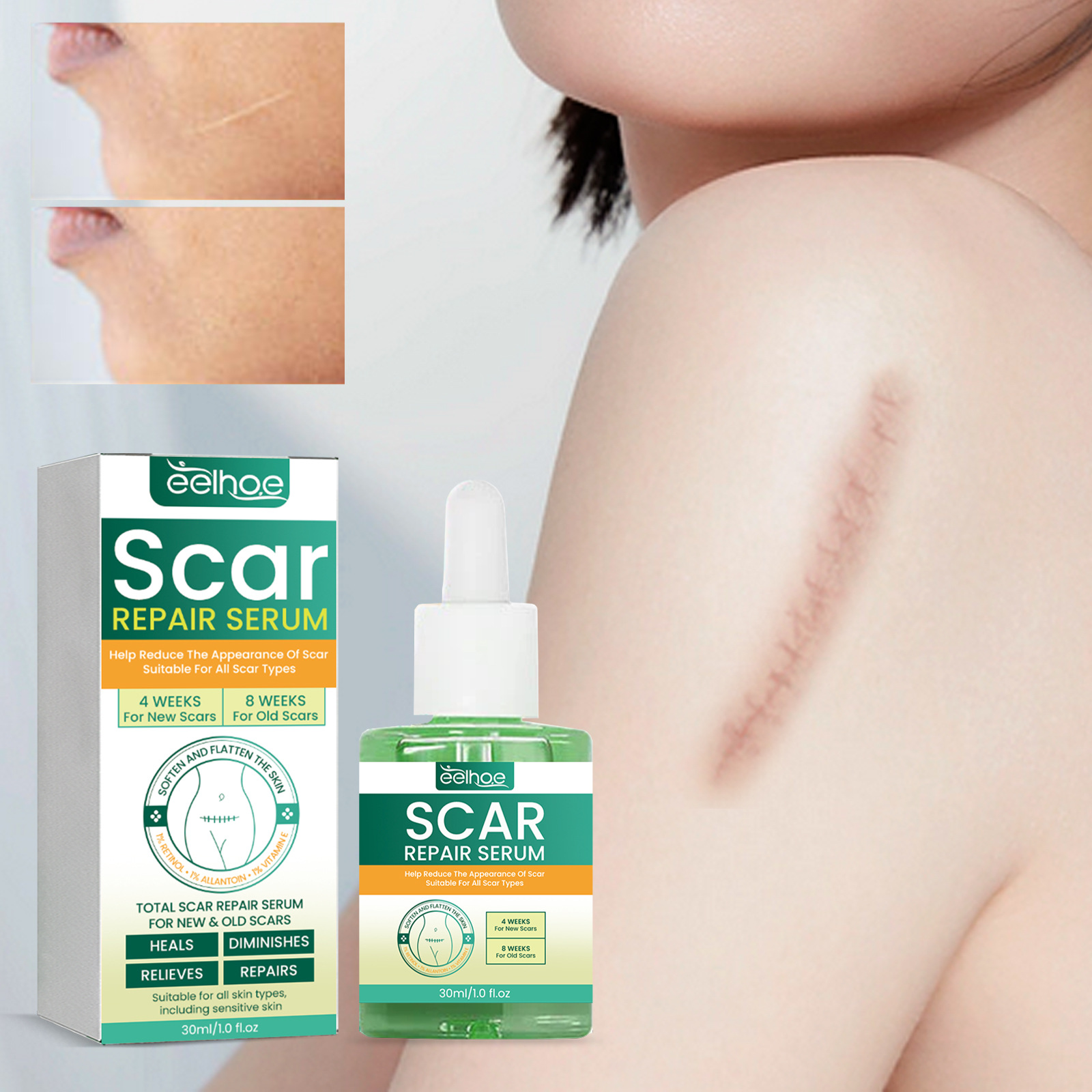 EELHOE repair to fade pregnancy scar smoothing skin care essence_voghion.com
