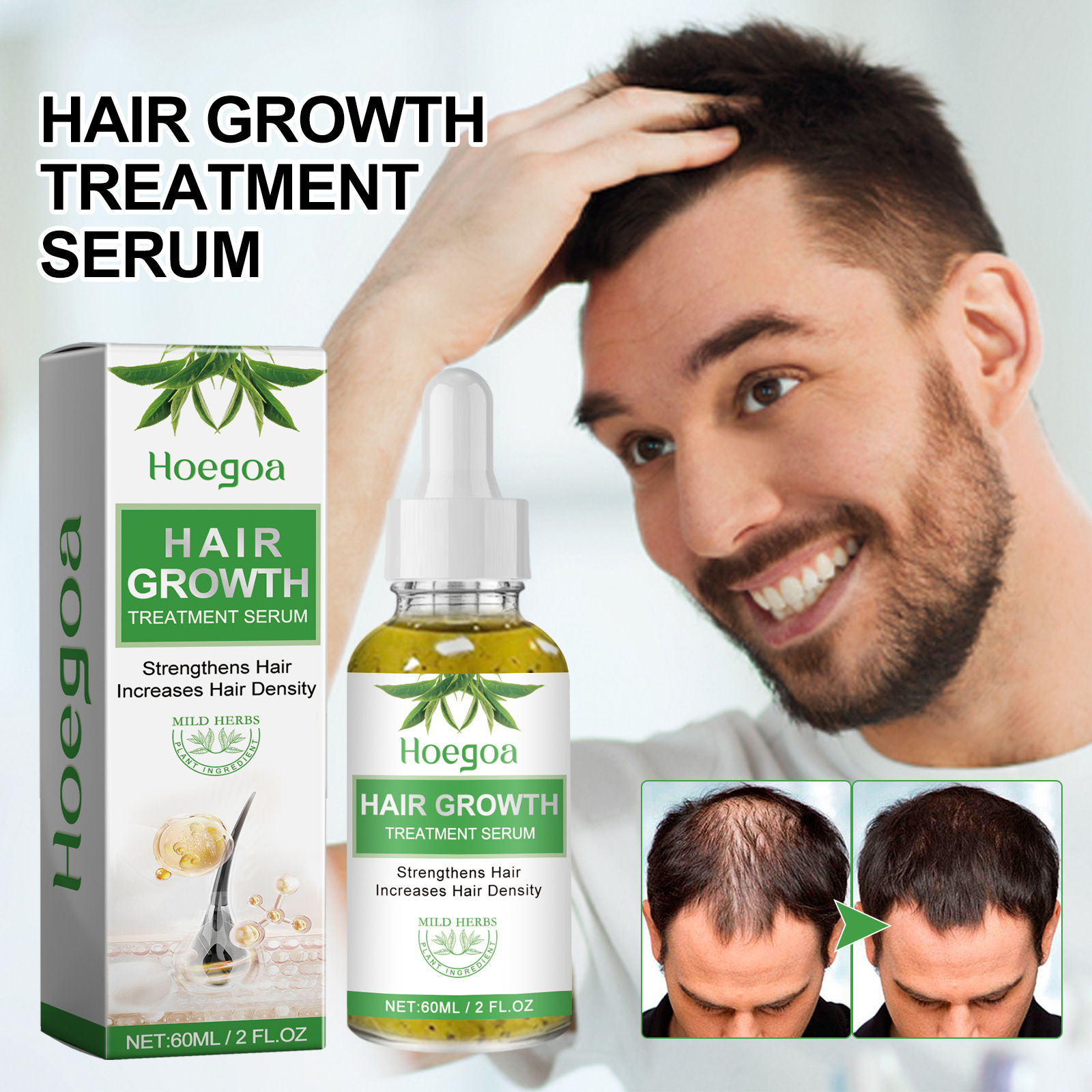 Hoegoa Dense Hair Essence Oil ass staark, zäh, fest, verhënnert Hoerverloscht. Mëll parfüméiert, natierlech an net fetteg._voghion.com