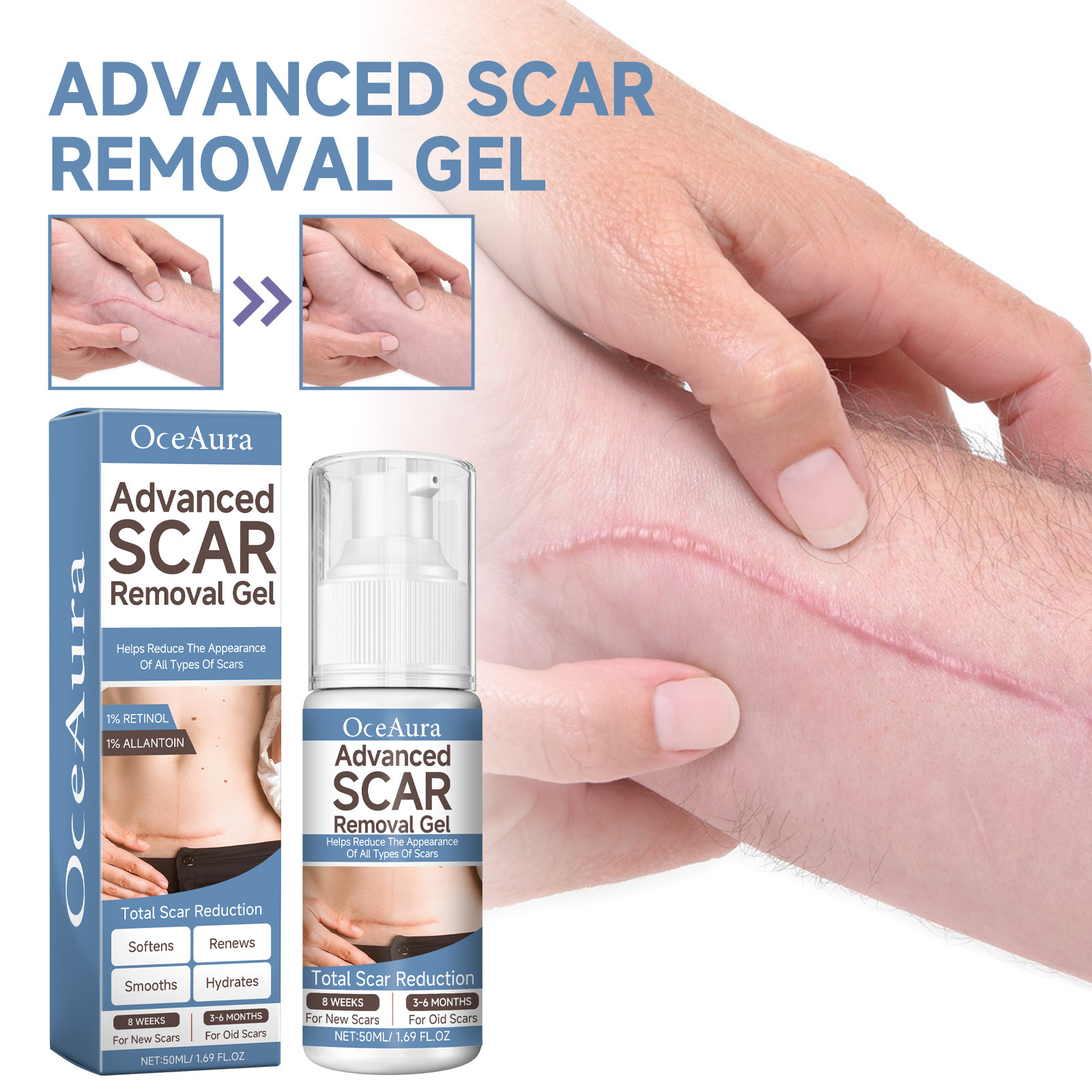 Gel de desalinizare OCEAURA, hidratat și netezit, pentru repararea cicatricilor chirurgicale ale pielii, pentru îngrijirea sarcinii._voghion.com
