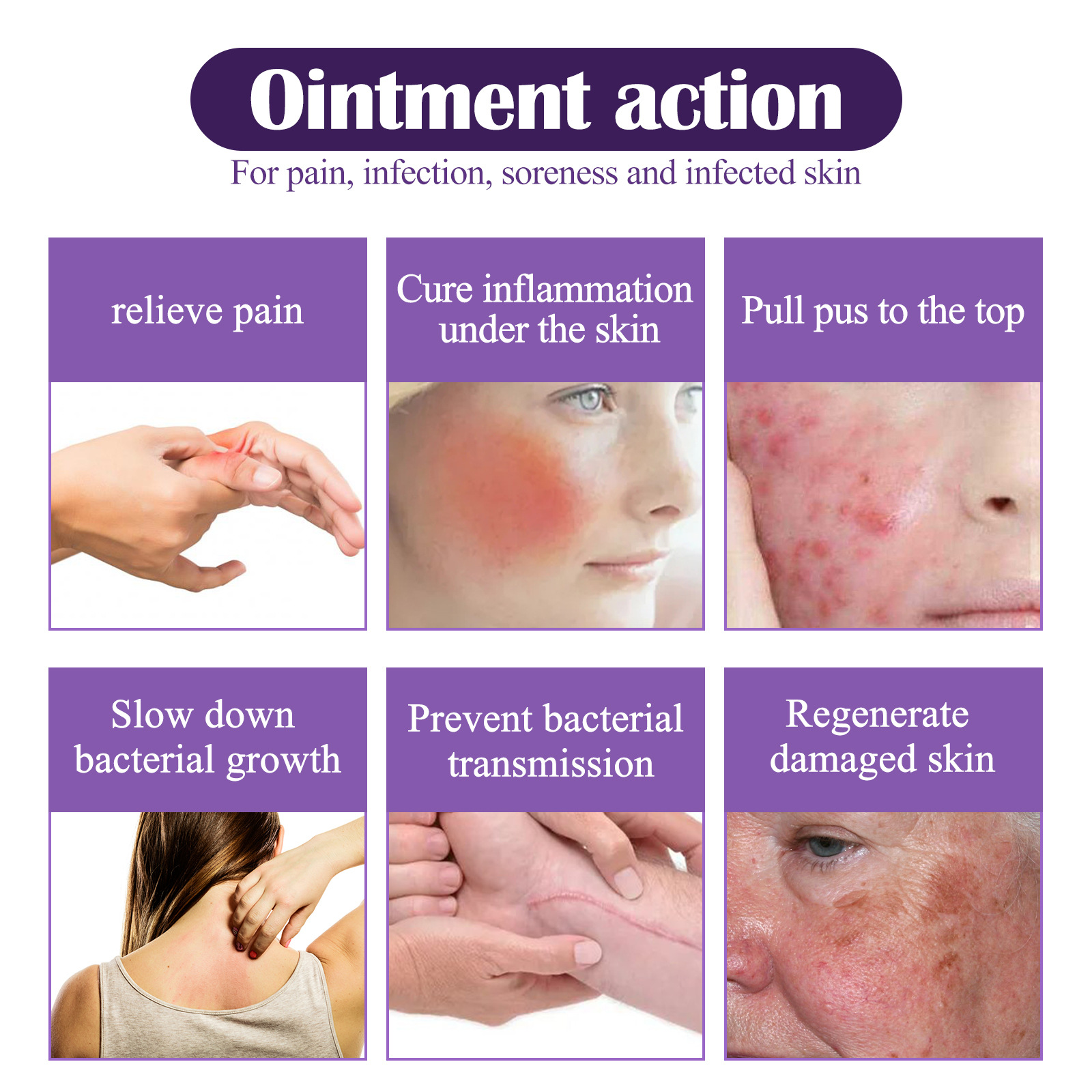 EELHOE Propolis-Reparaturcreme zur Linderung subkutaner Knoten, spendet der Haut Feuchtigkeit, repariert sanft und reinigt die Haarfollikel_voghion.com