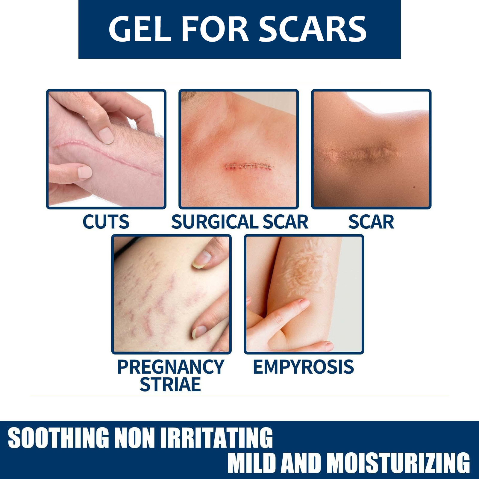 West&Month Lightening repariert geschädigte Haut, hellt Narbennarben auf und glättet das Hautpflegegel_voghion.com