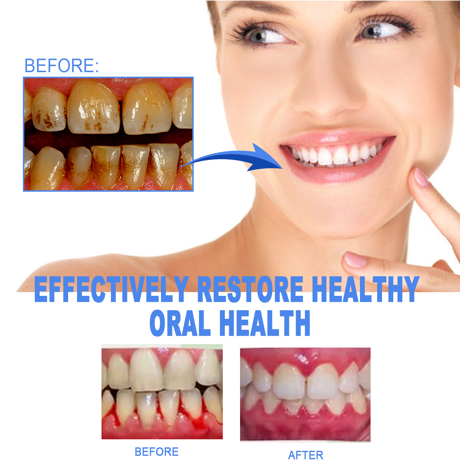 EELHOE Mild Cleaning Yellow Tooth Stain Fresh Care Gel_voghion.com