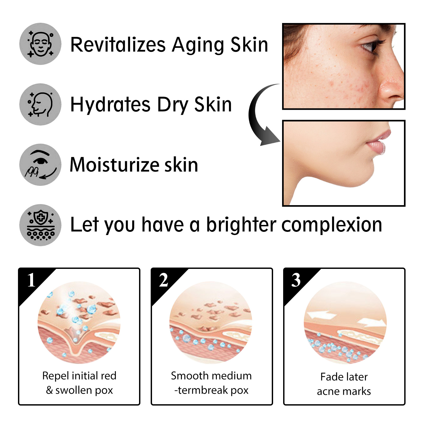 La crème pour le visage à l'escargot OUHOE éclaircit les ridules, hydrate et raffermit la peau, essence anti-âge_voghion.com