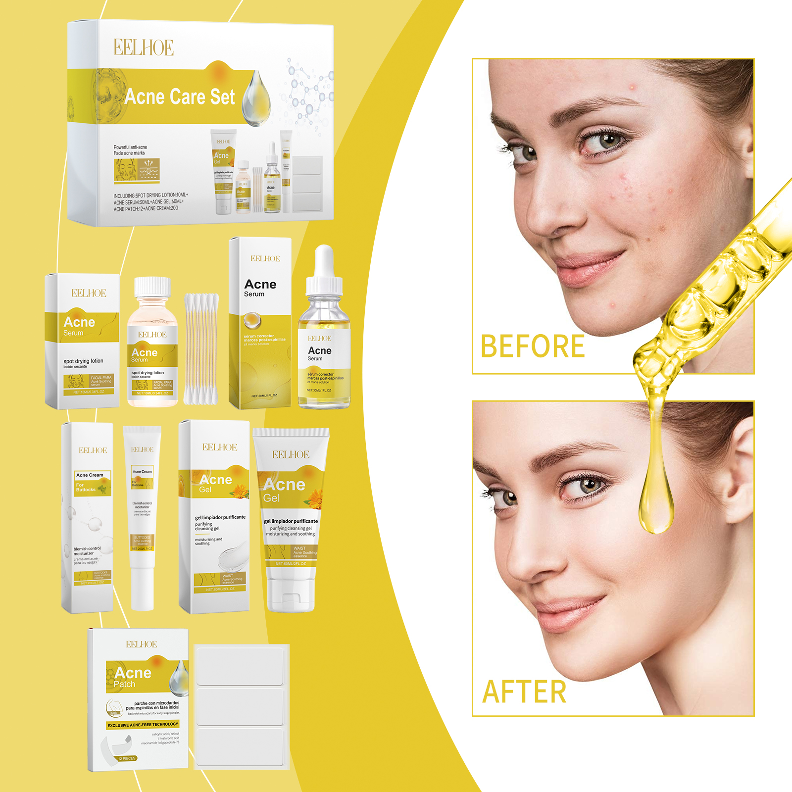 EELHOE Acne Skin Care Set Skin Care For Acne Skin Is Suitable For Moisturizing And Beautify Soft Skin_voghion.com