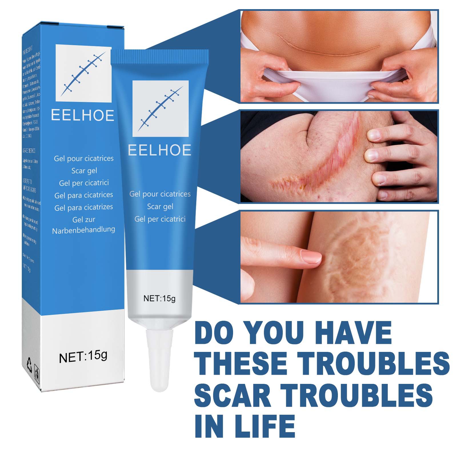 EELHOE scar gel external cold compress cream skin damage repair type softening, smoothing and moisturizing_voghion.com