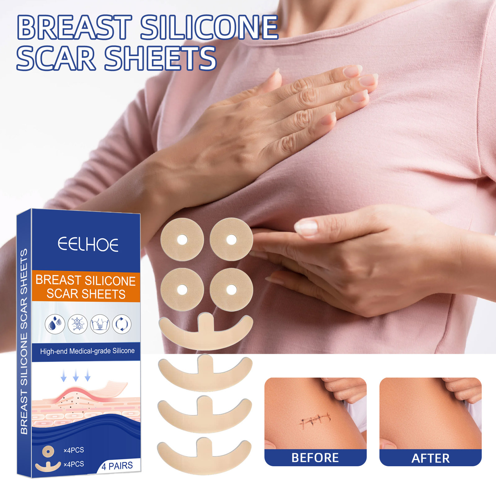 Le patch anti-cicatrice EELHOE répare la peau de manière confortable, légère et lisse les cicatrices de chirurgie mammaire_voghion.com