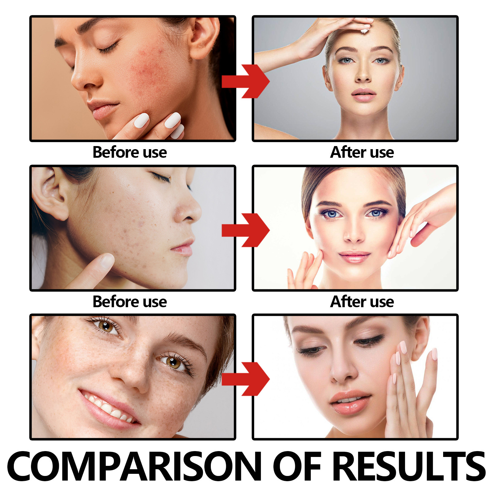 Esența facială de calamină Hoygi îmbunătățește uscăciunea, aspectul tern al pielii, acneea, hidratează și conferă volum pielii._voghion.com