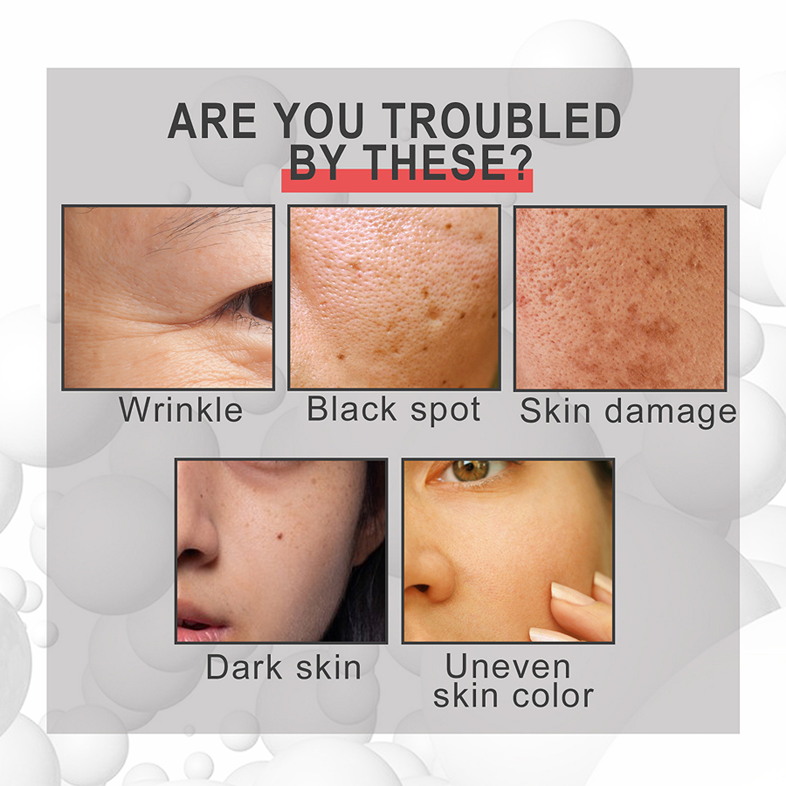 Le liquide d'essence facial anti-âge Hoygi peut éclaircir les rides des pattes d'oie, réduire les taches brunes, rendre la peau ferme et élastique_voghion.com