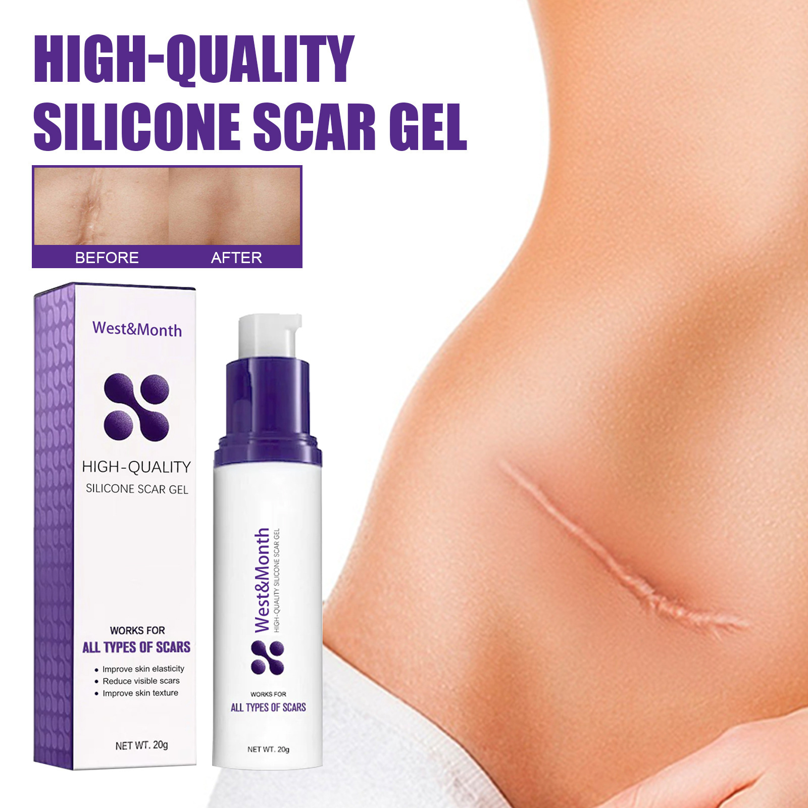 West&Month to lighten acne marks, pregnancy surgery scar repair skin smoothing care cream_voghion.com