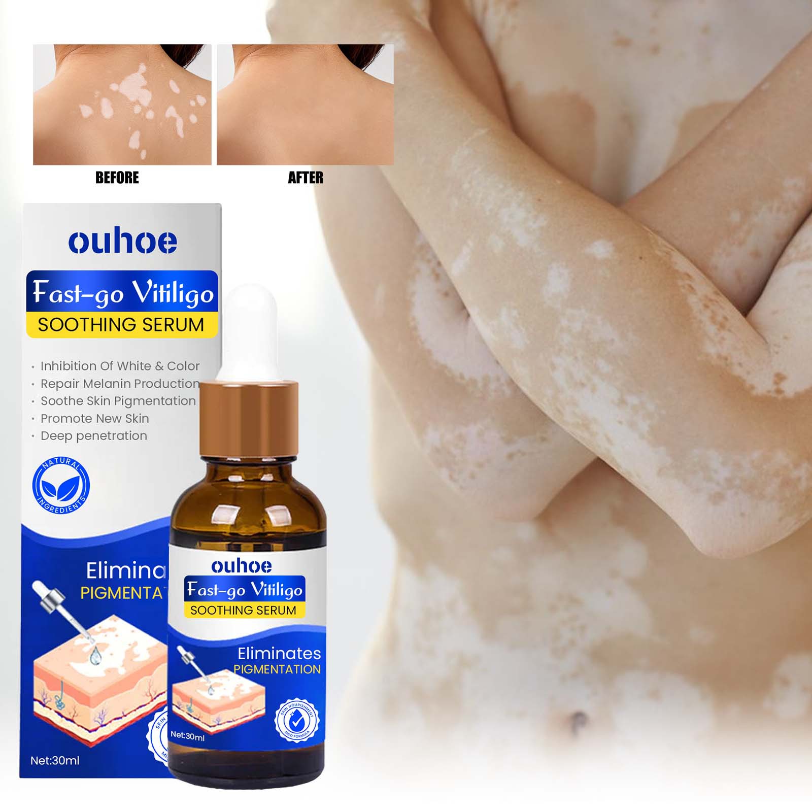 OUHOE Schiarisci le macchie bianche Ripara l'essenza idratante per la cura della pelle dal tono uniforme_voghion.com