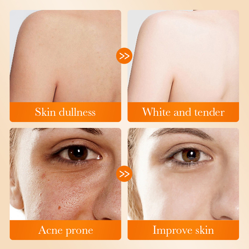 Kojic Acid Whitening Soap For Body Cleansing And Brightening_voghion.com