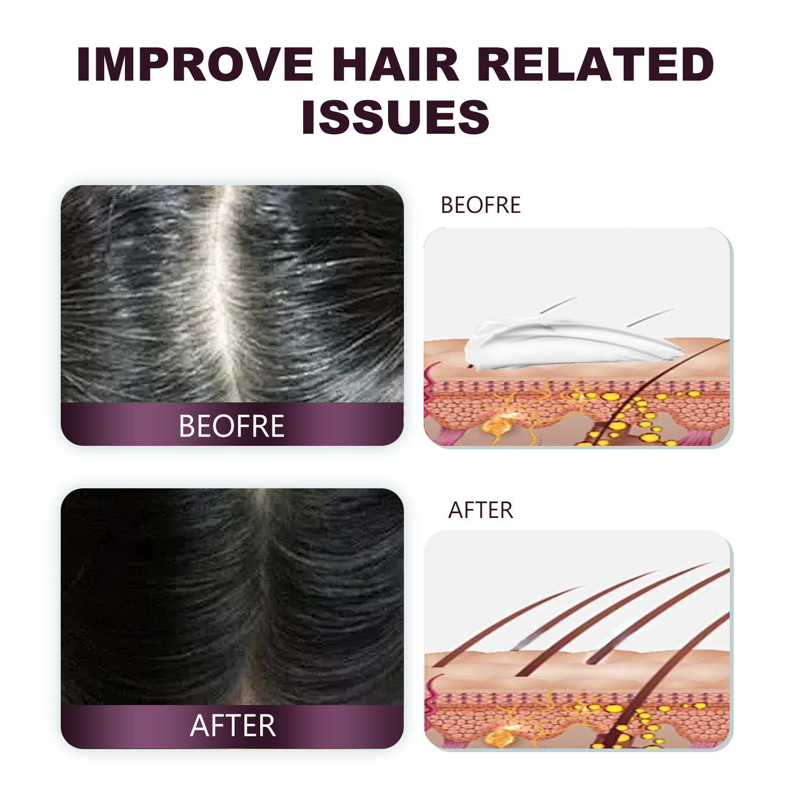WIYUN Creme für dichtes Haar Spendet Feuchtigkeit an den Haarwurzeln, stärkt das Haar, verhindert Haarausfall und festigt das Haar für flauschiges, weiches, glänzendes und dichtes Haar._voghion.com