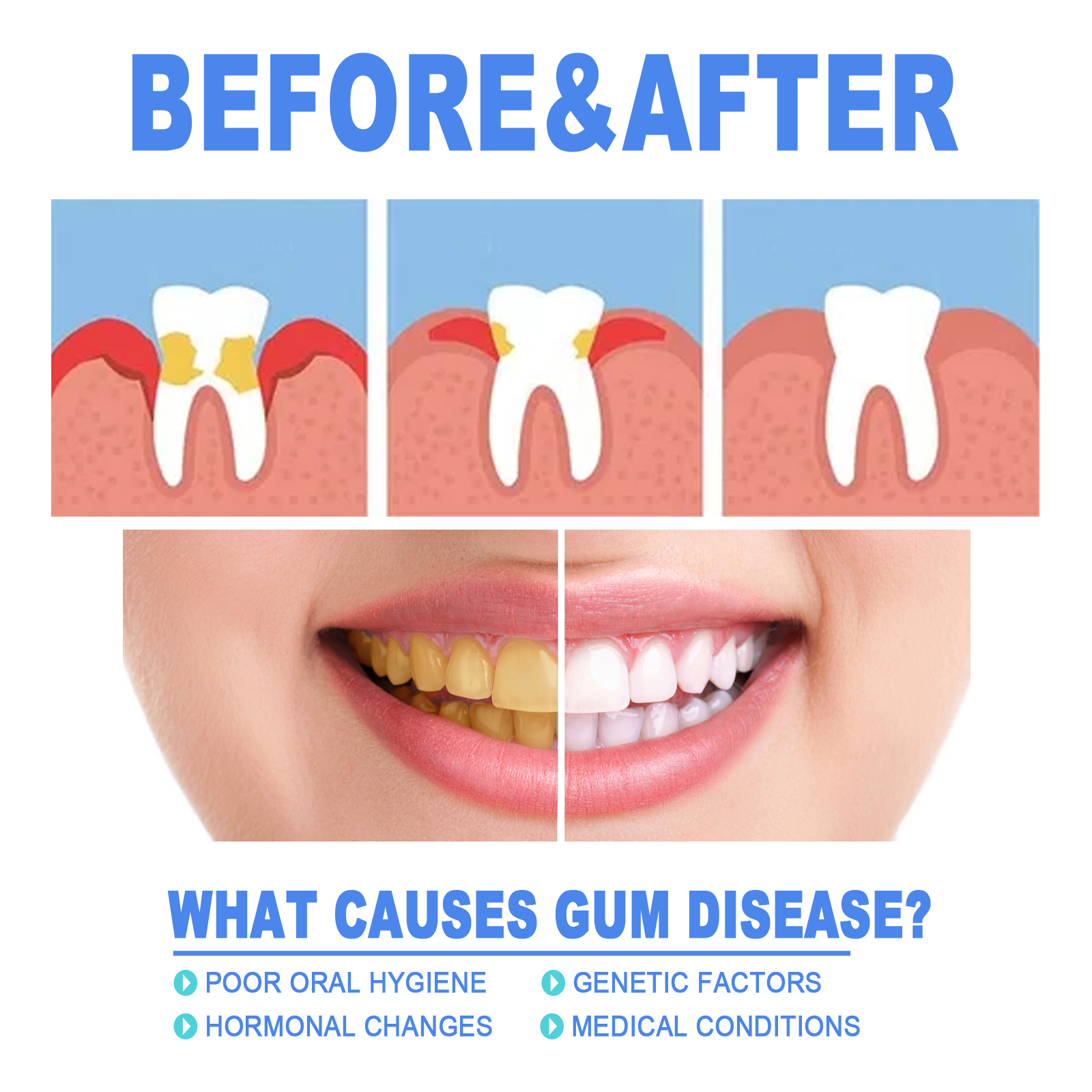 EELHOE Mild Cleaning Yellow Tooth Stain Fresh Care Gel_voghion.com