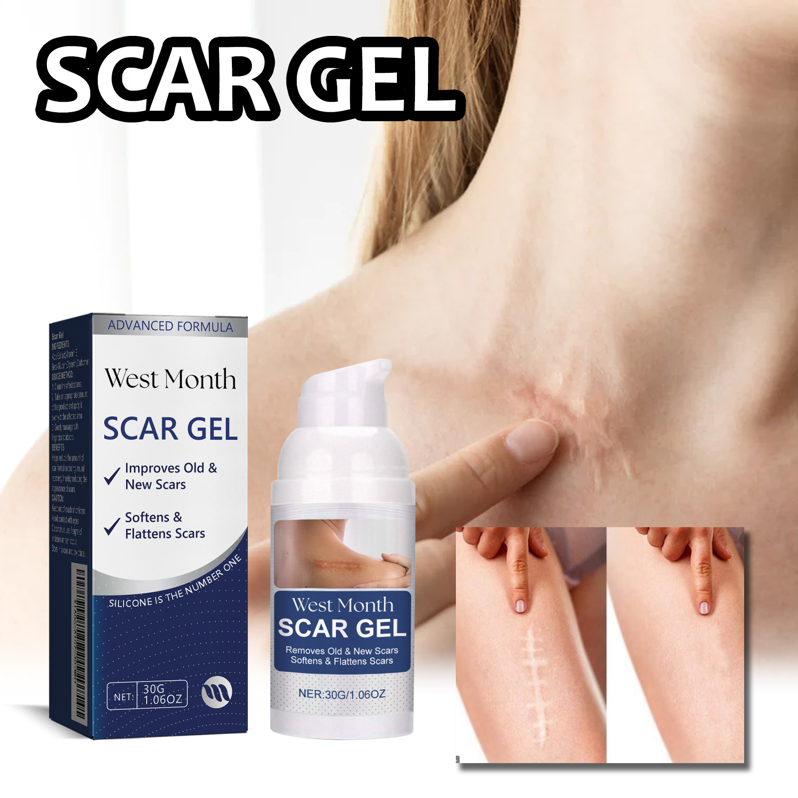 West&Month Lightening repariert geschädigte Haut, hellt Narbennarben auf und glättet das Hautpflegegel_voghion.com