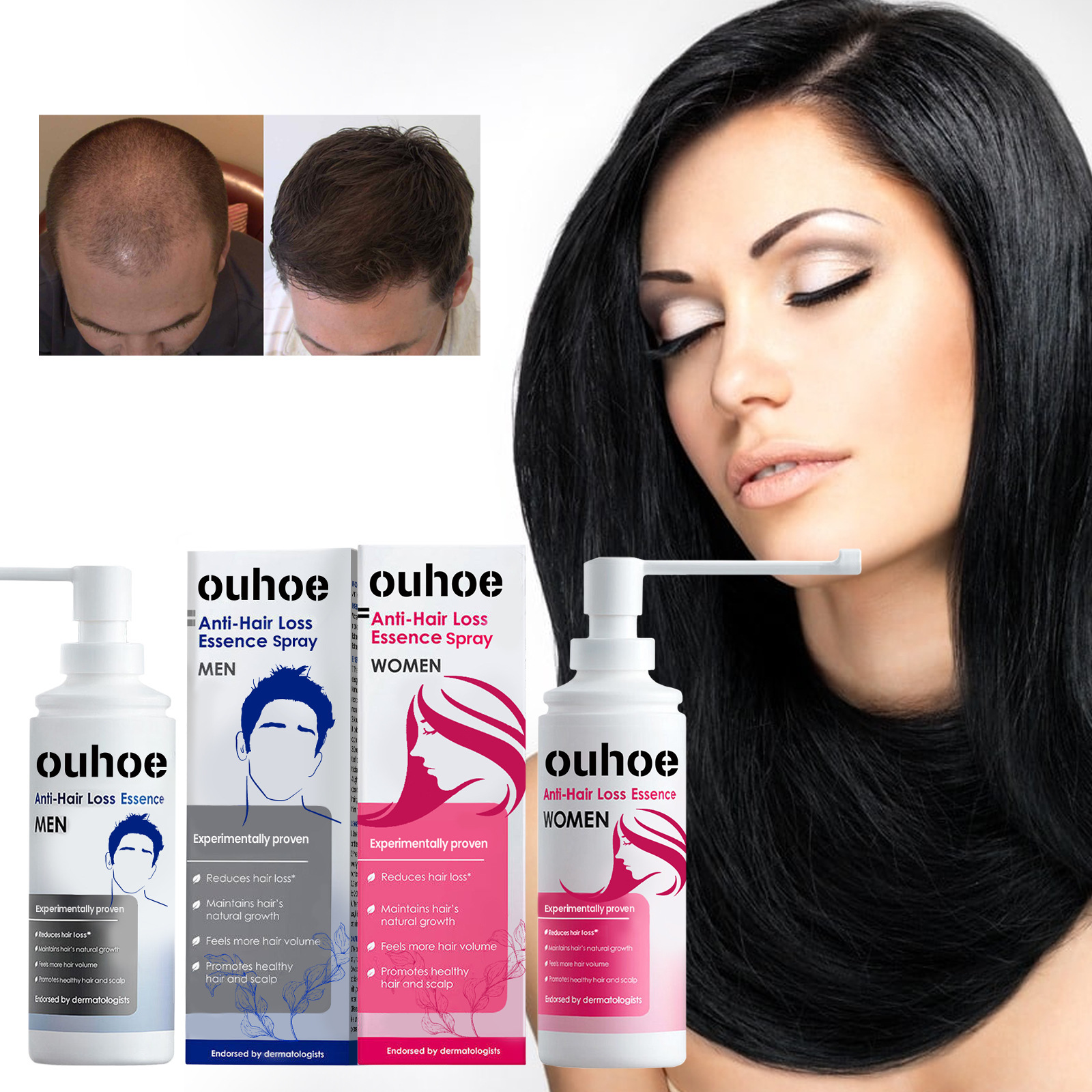 OUHOE anti drop essence, firming, repairing, root thickening, nutrition, tough scalp care, hair essence_voghion.com