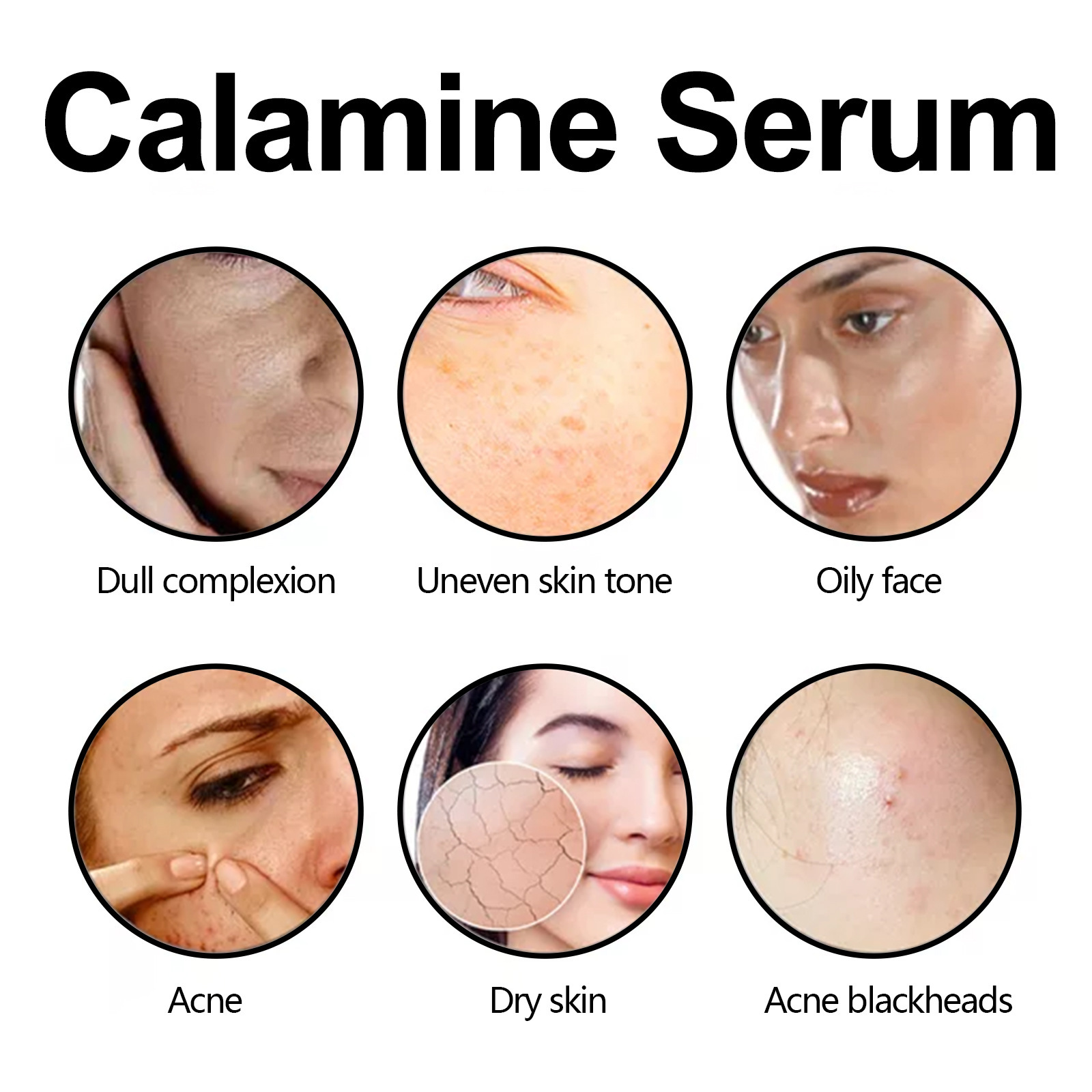 Esența facială de calamină Hoygi îmbunătățește uscăciunea, aspectul tern al pielii, acneea, hidratează și conferă volum pielii._voghion.com