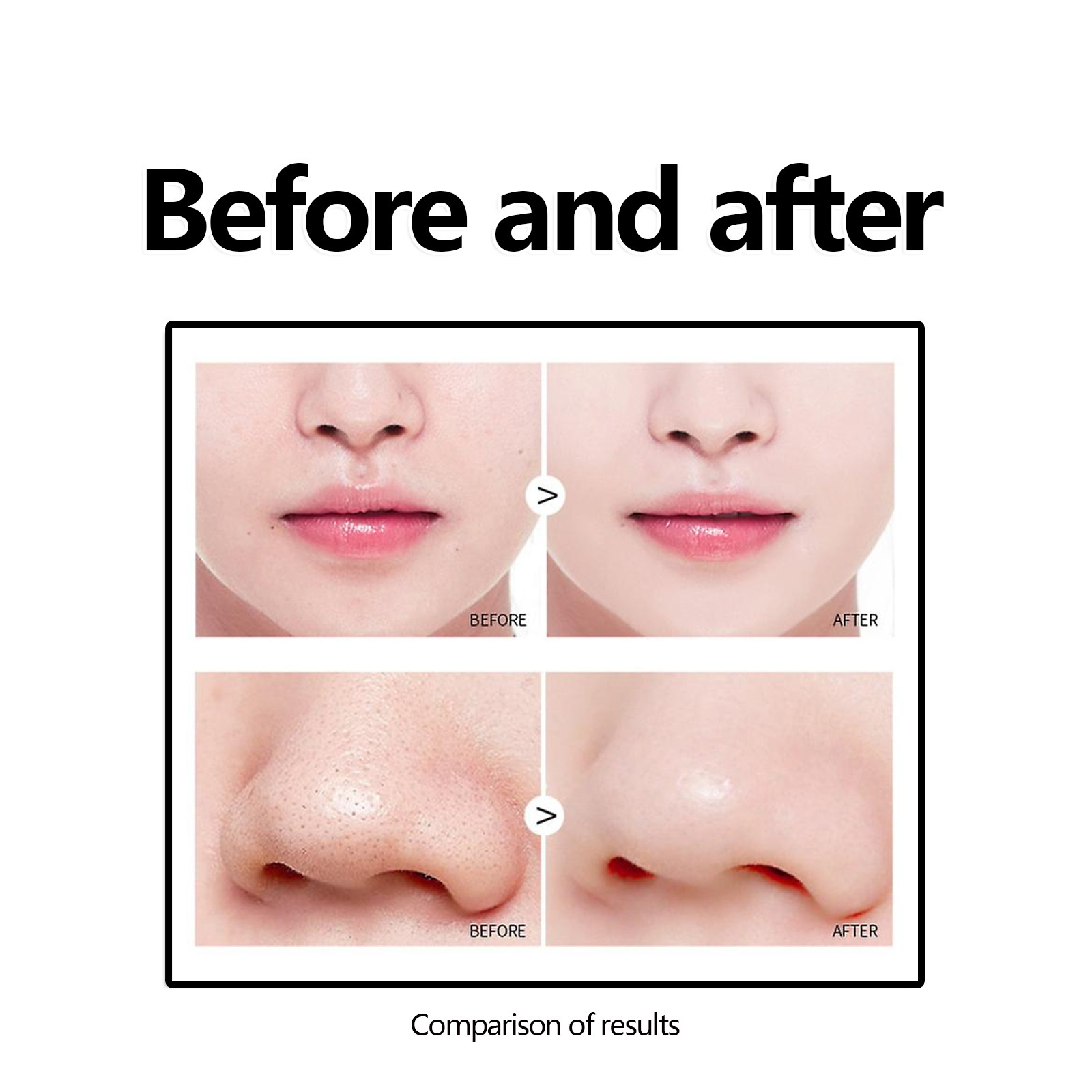 Mascarilla facial desmaquillante West&Month que hidrata el rostro, limpia los puntos negros y el acné, aclara las marcas del acné y afina los poros._voghion.com