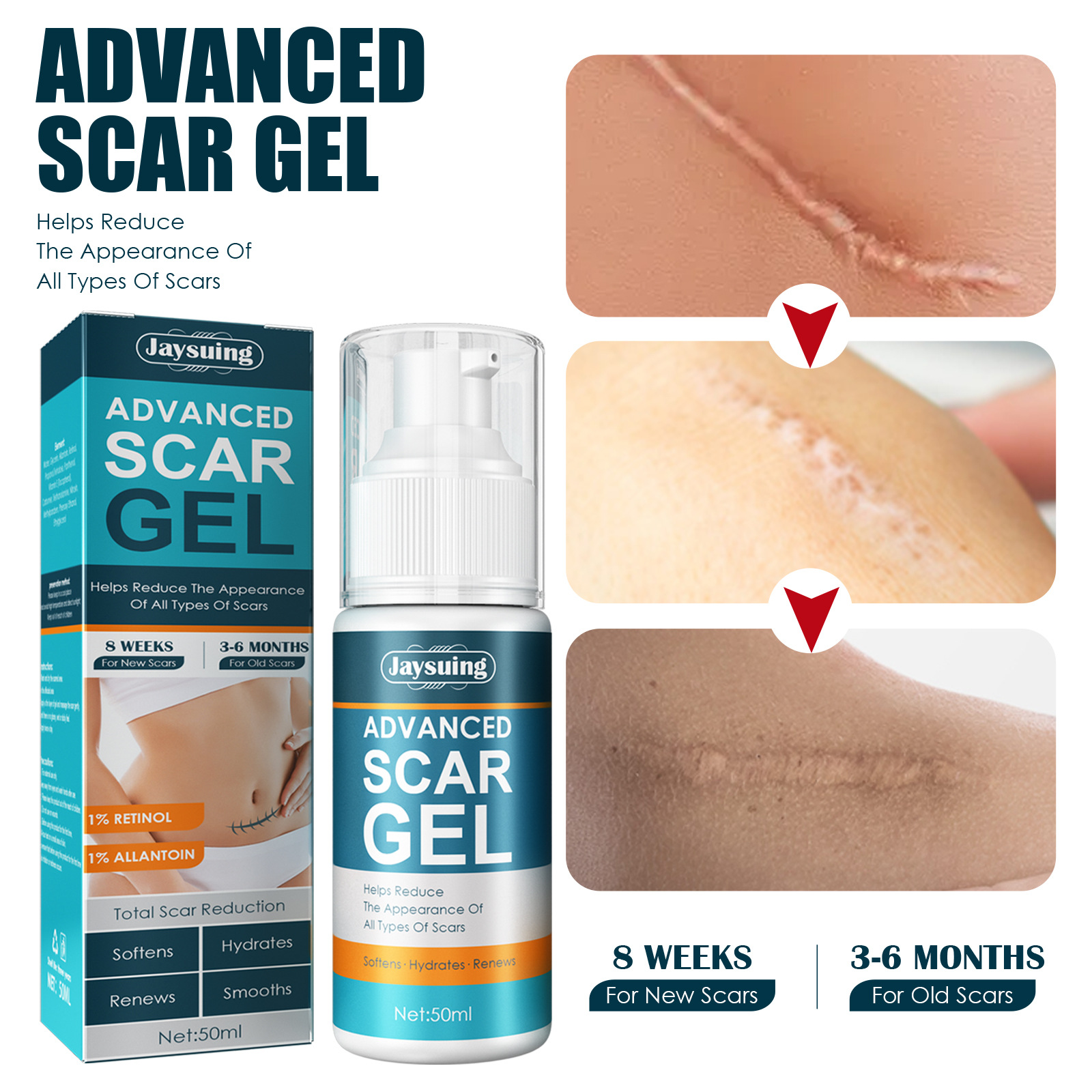 Jayswing Lightening gel Repair Cream Postpartum Pregnancy Scar Surgery Smooths Skin_voghion.com