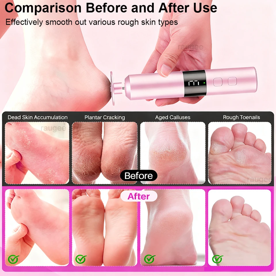 Râpe pieds électrique rechargeable sans fil pour callosités_voghion.com