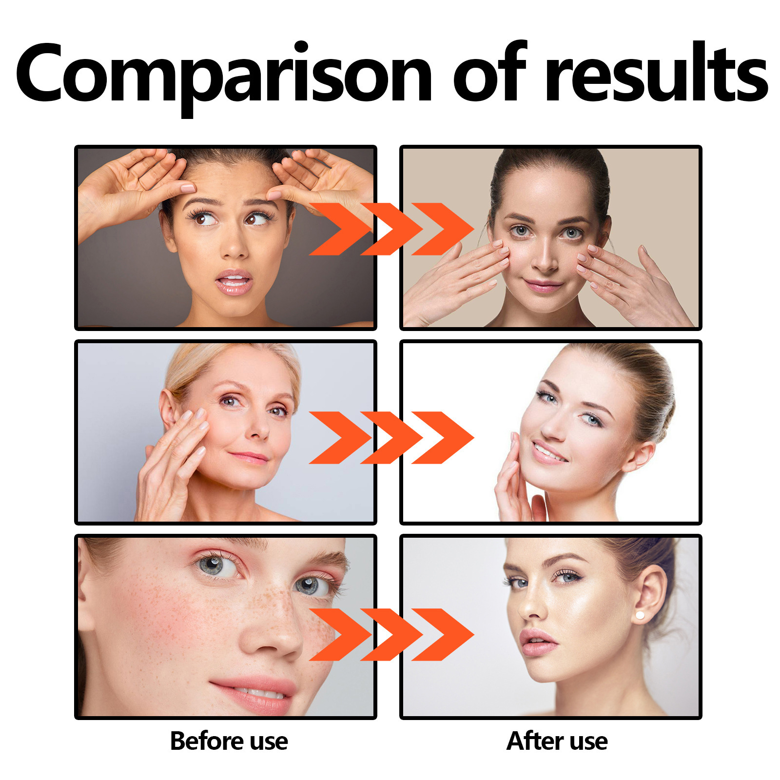 Le liquide d'essence facial anti-âge Hoygi peut éclaircir les rides des pattes d'oie, réduire les taches brunes, rendre la peau ferme et élastique_voghion.com