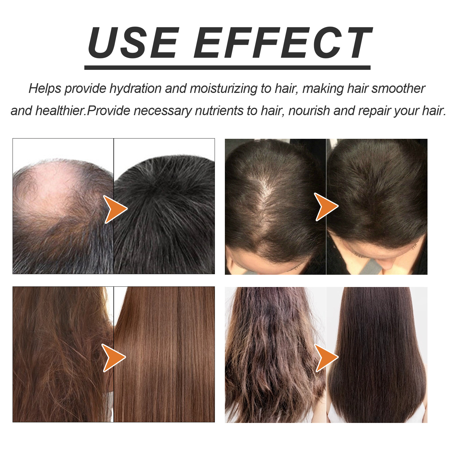 Hoegoa Dense Hair Essence Oil ass staark, zäh, fest, verhënnert Hoerverloscht. Mëll parfüméiert, natierlech an net fetteg._voghion.com