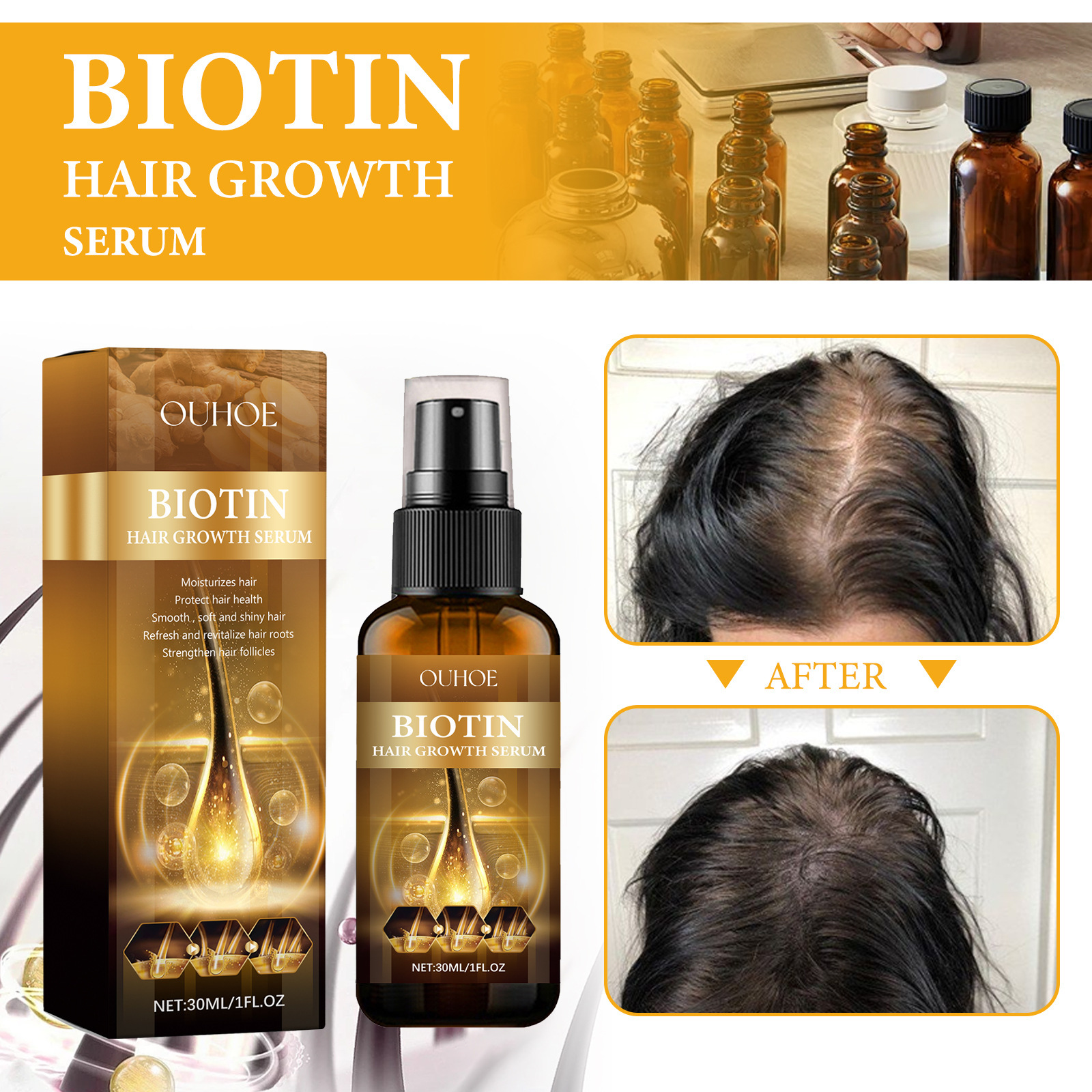 OUHOE Biotin hrani korijen, popravlja suhu i dlakavu kosu, sprječava fiksiranje guste kose_voghion.com