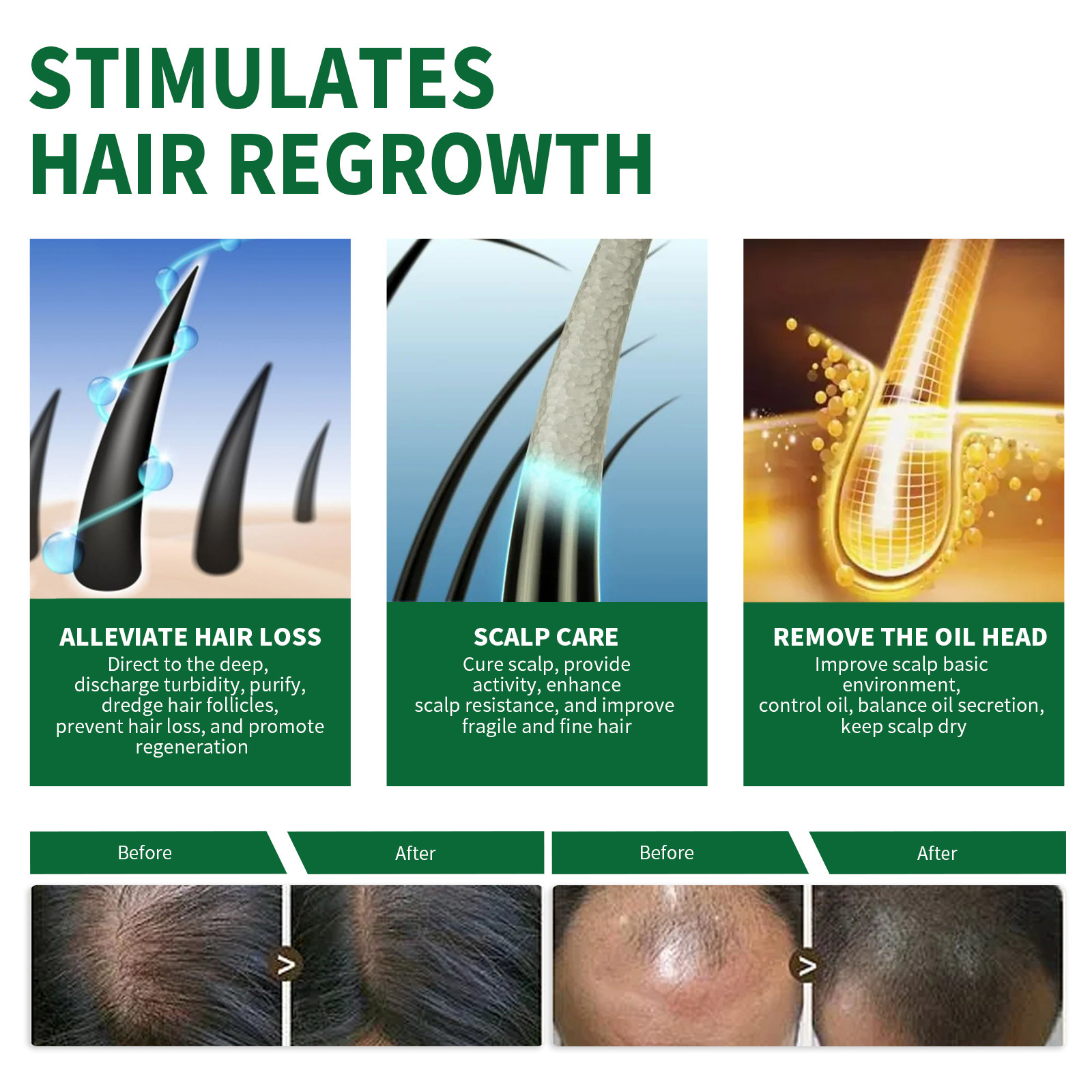 OUHOE Growth Repairs Follikelskada Torrt hårigt hår Tjockt spray mot håravfall_voghion.com